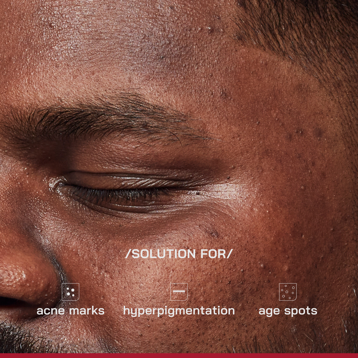 Image of Proven Honest Derma /PHD / 2% Alpha Arbutin Depigmentation Serum with 2% Tyrobright