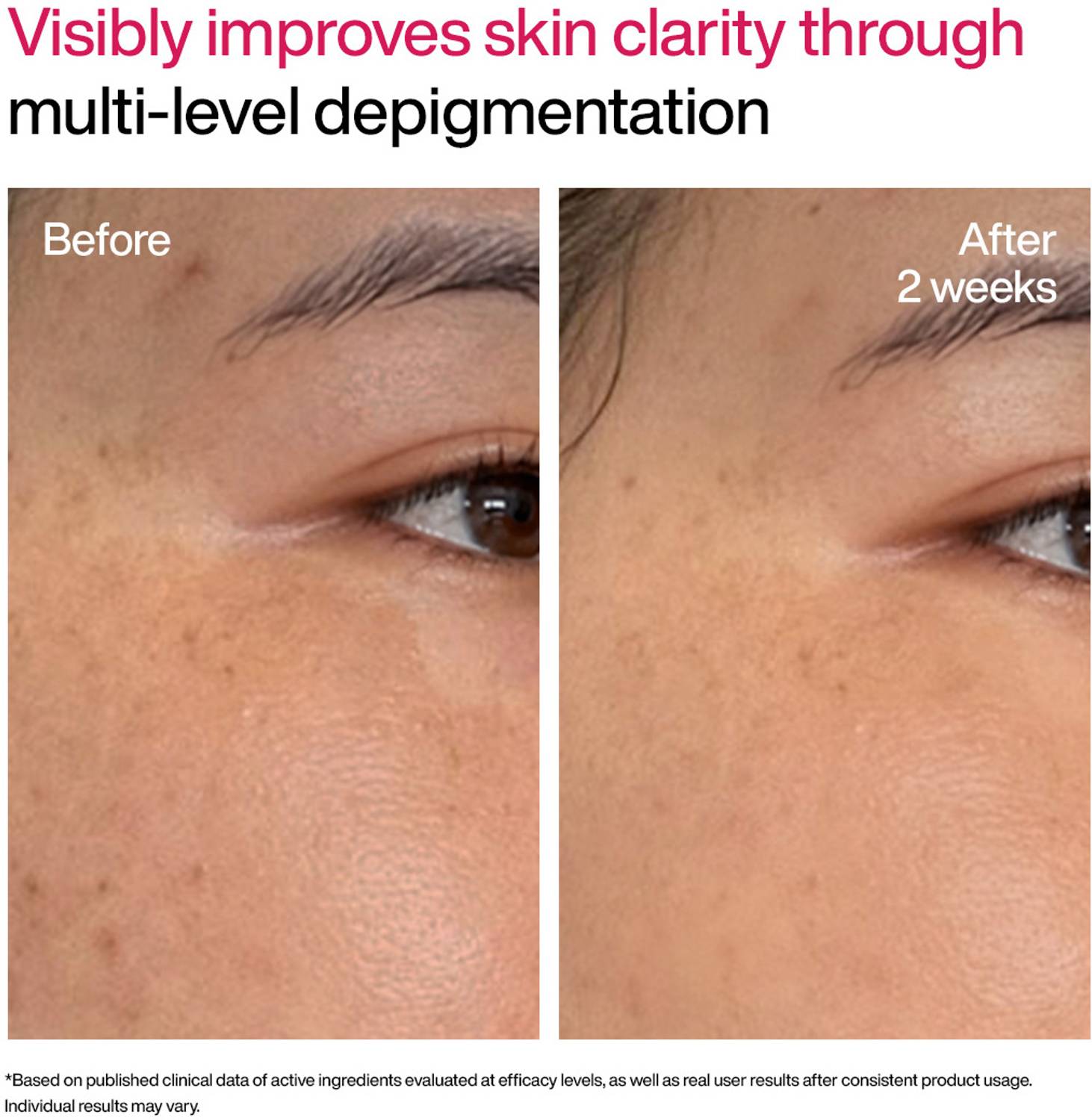 WishCare Advanced Dark Spot TXA Shot - Image 3