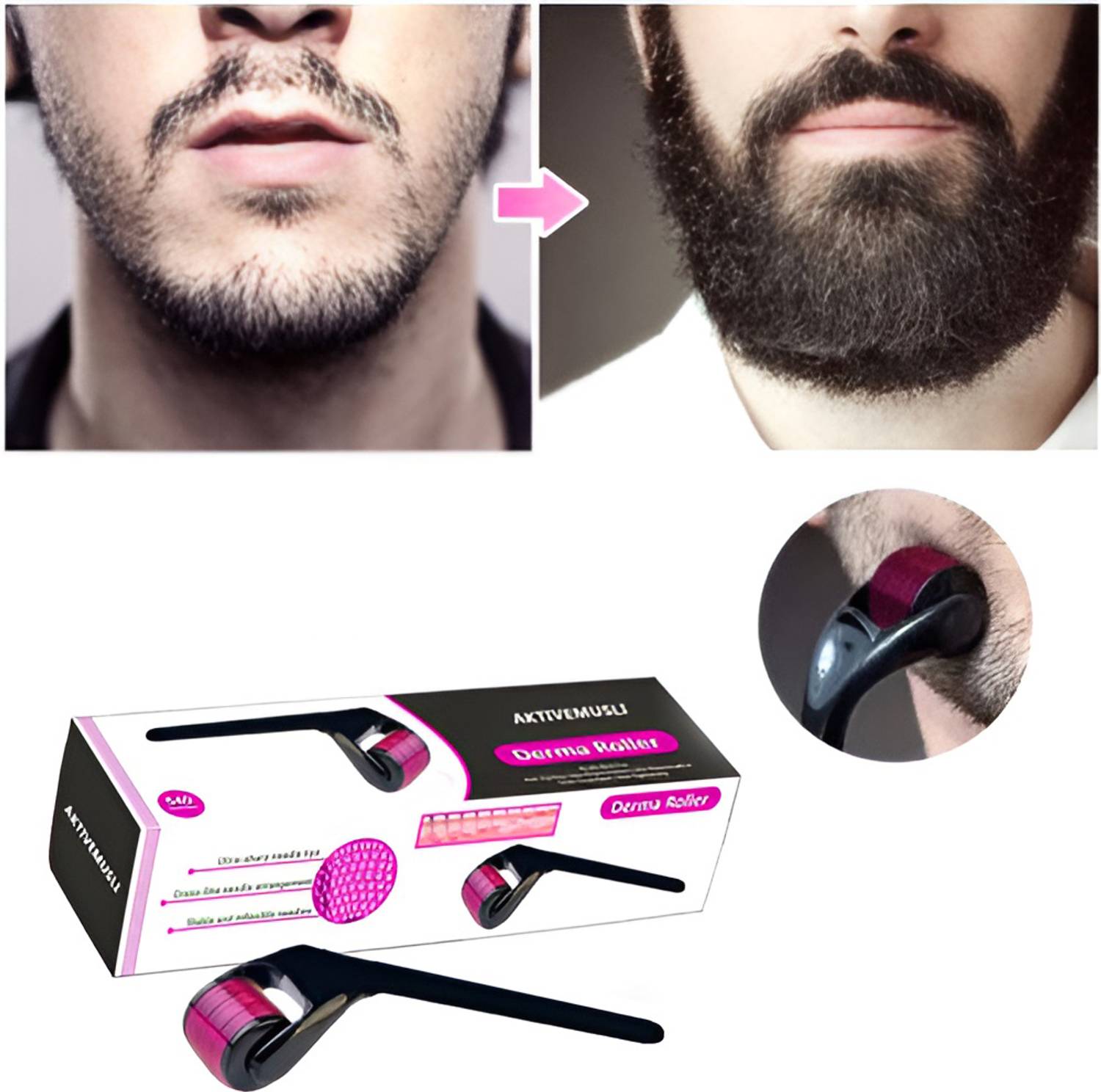 Aktivemusli Derma Roller for Men | For Scalp & Beard | Activates Hair Follicles | 540 (0.5 mm).