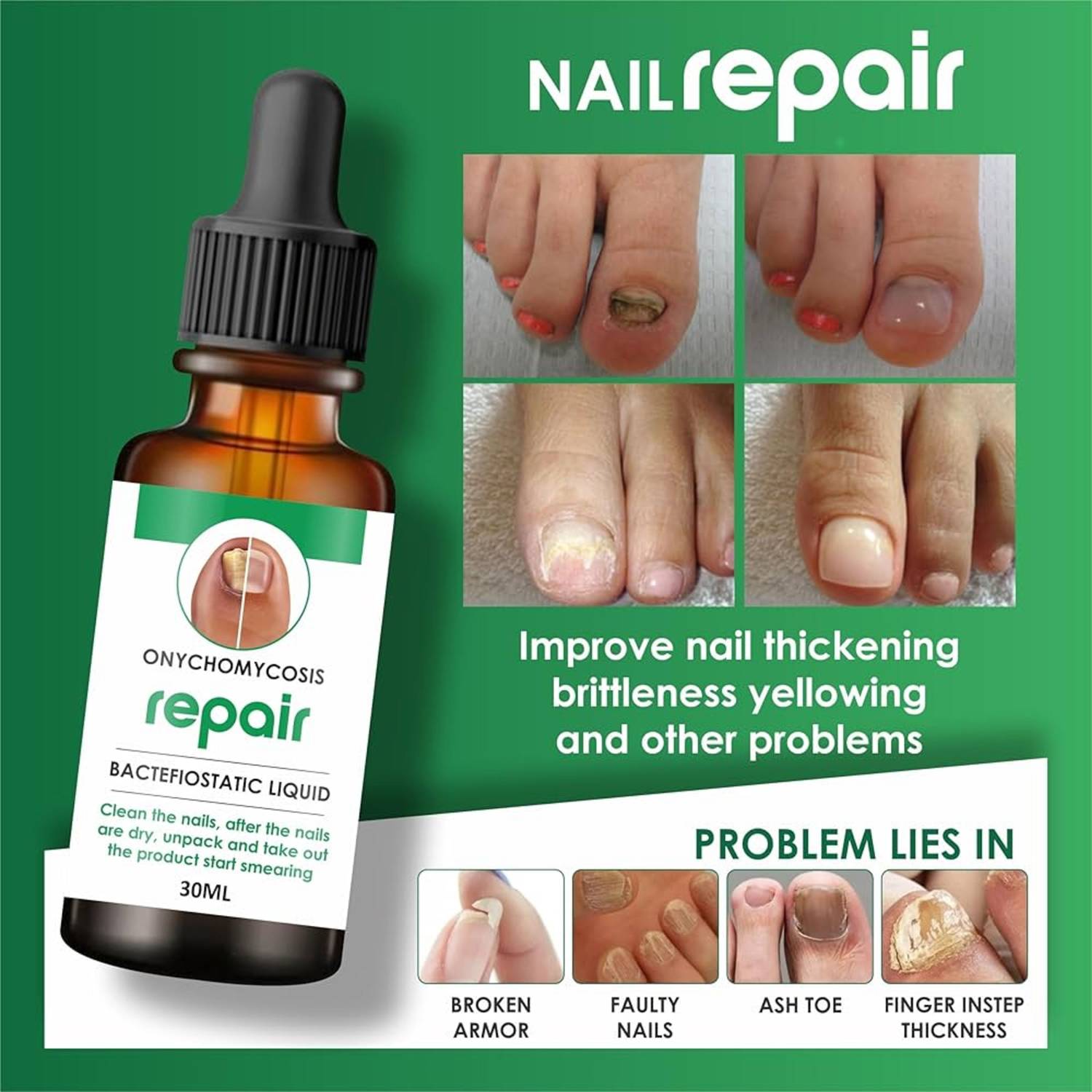 AQUORAL Nail Fungus Treatment Repair Foot Removal Toe Fungal Infection Liquid for nails