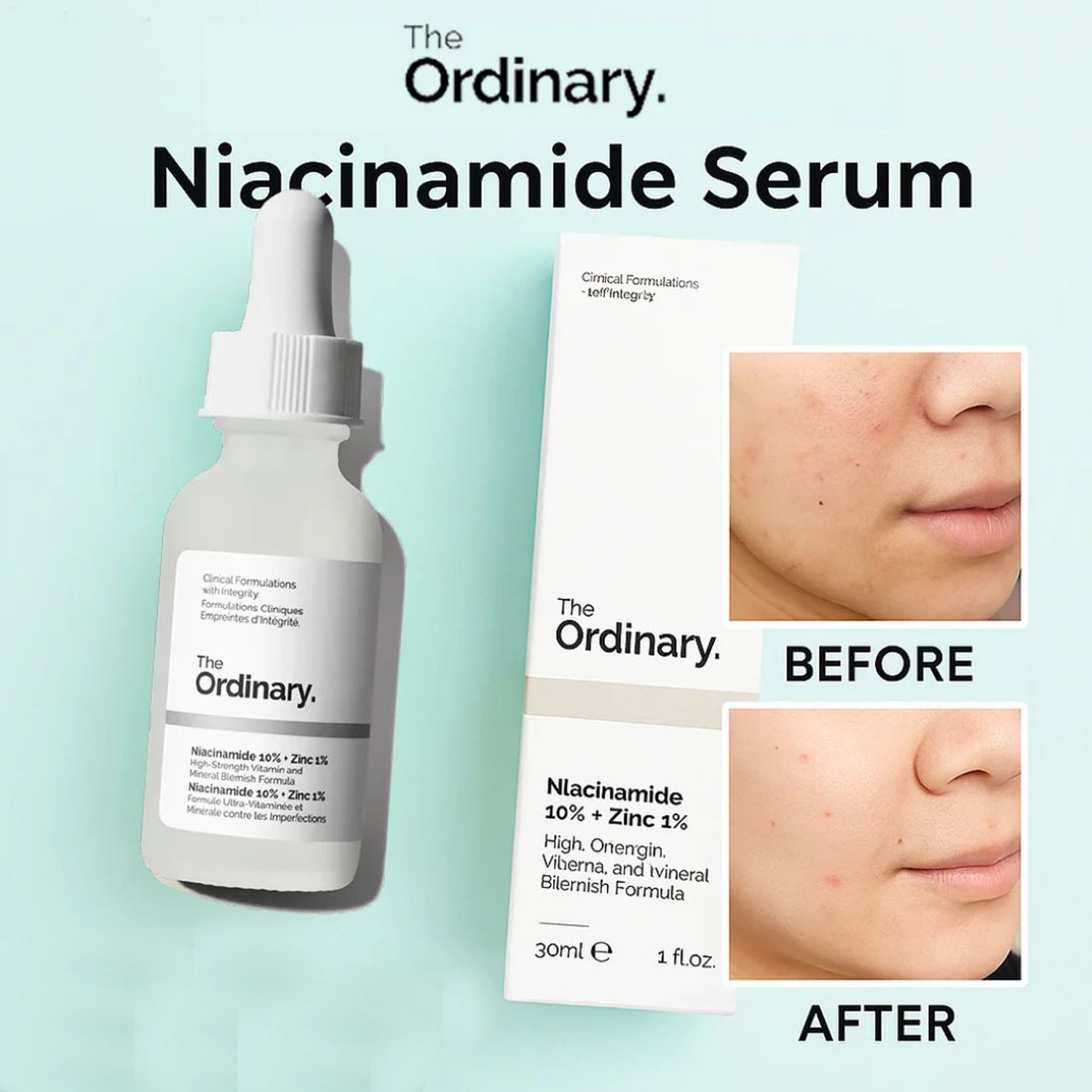 Image of ANUA the Ordinary Niacinamide 10% + Zinc 1% Serum for a smoother appearance and brightening