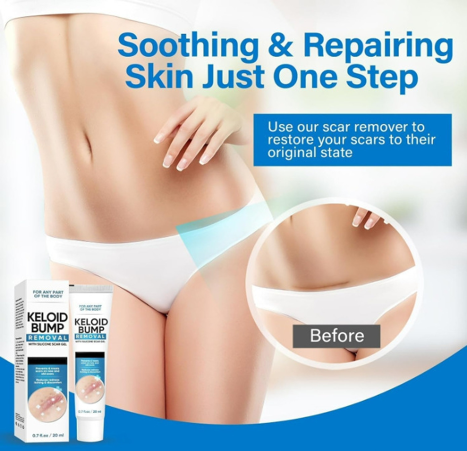 Image of GHAPLU White Keloid & Scar Removal Silicone Gel Advanced Formula for Old & New Scars - Helps Reduce Keloid Bumps, Redness & Itching - Fast Absorbing Skin Repair Gel for Smooth & Healthy Skin