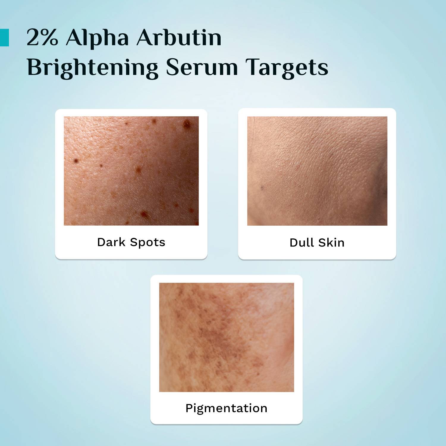 Pilgrim Alpha Arbutin & Vitamin C Brightening Serum 30ml - Image 5