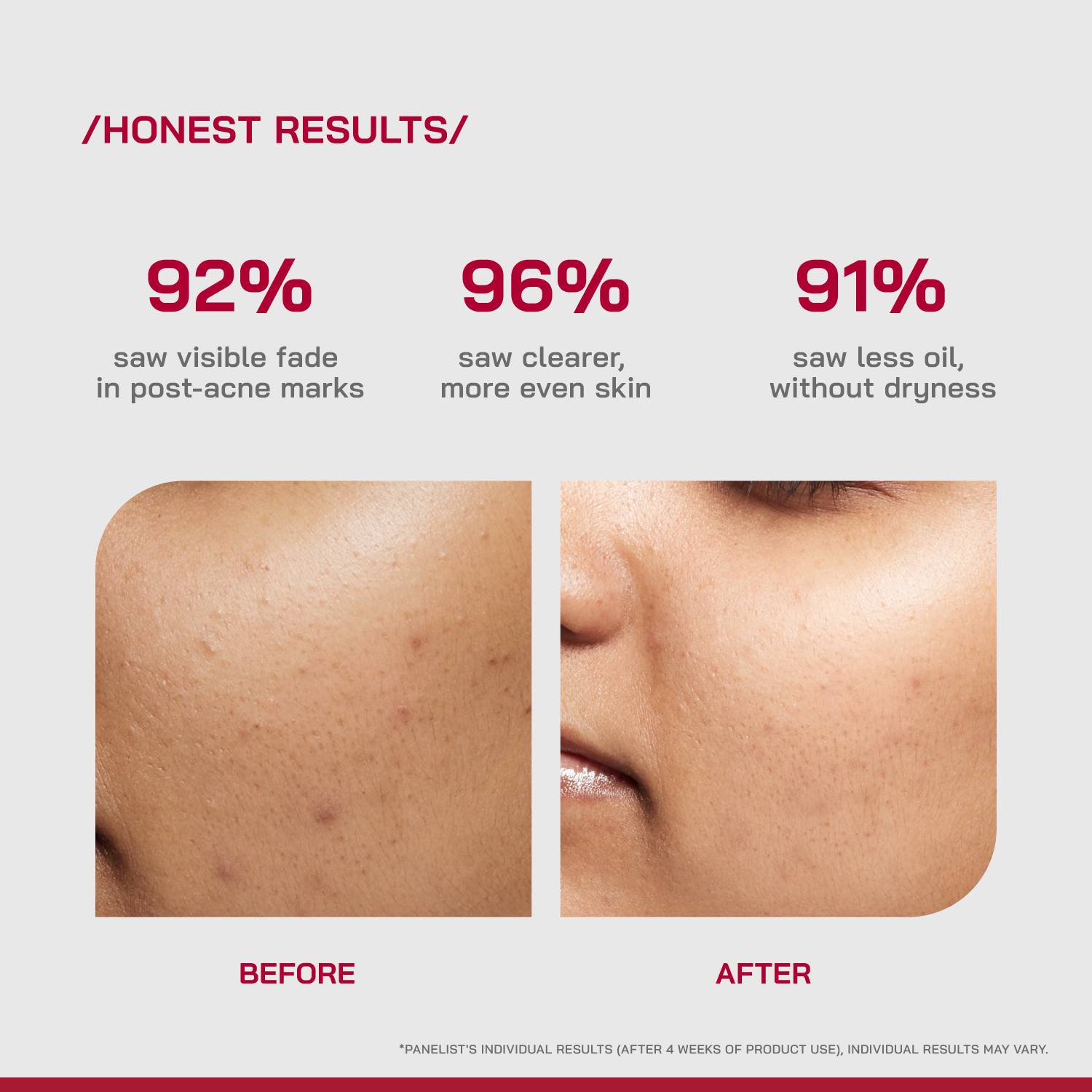 Proven 10% Niacinamide Spot Correcting Serum 30ml - Image 5