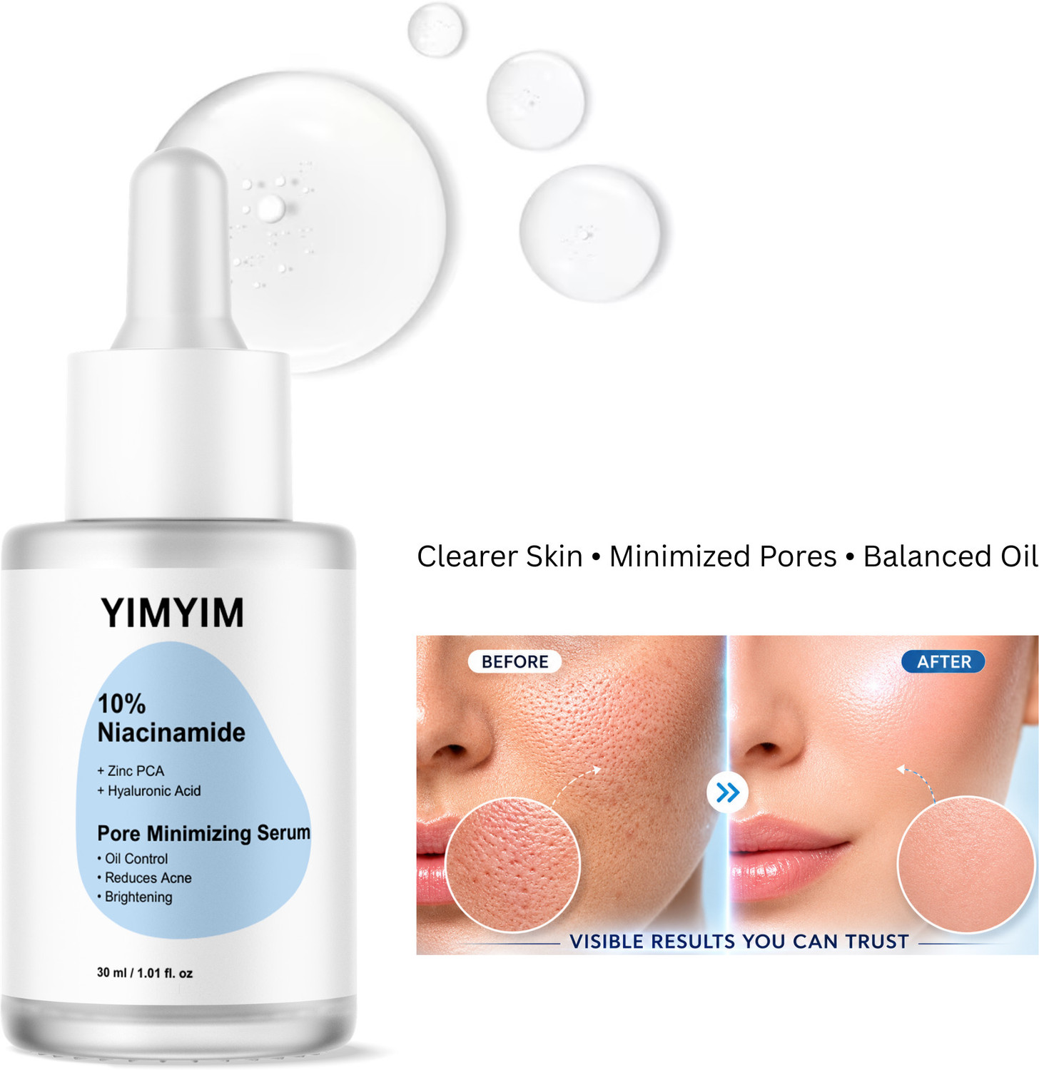 Image of YIMYIM 10% Niacinamide Face Serum with Zinc PCA & Hyaluronic Acid | Pore Minimizing, Oil Control, Acne Reducing & Brightening Serum