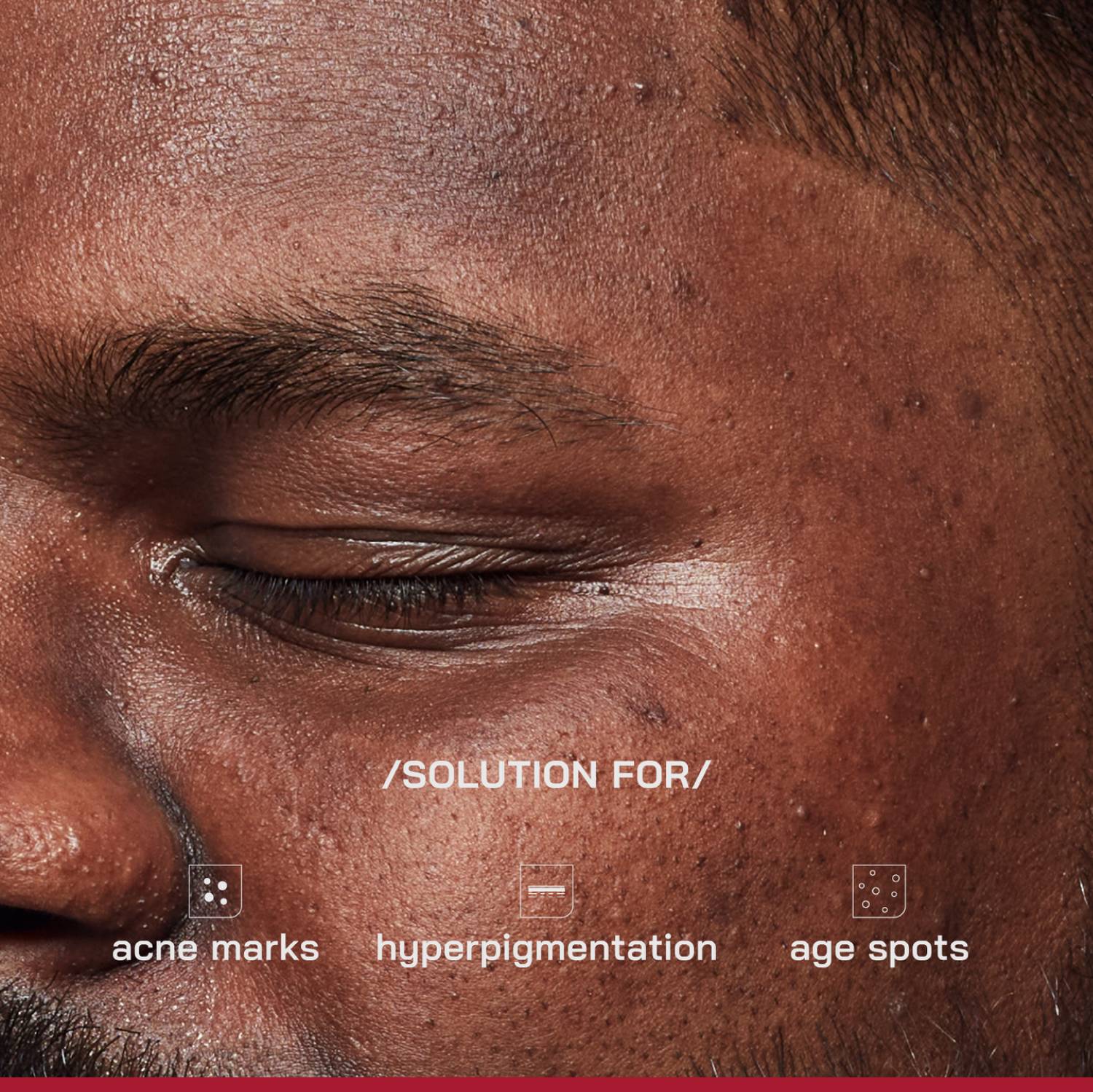 Proven 2% Alpha Arbutin Depigmentation Serum - Image 3
