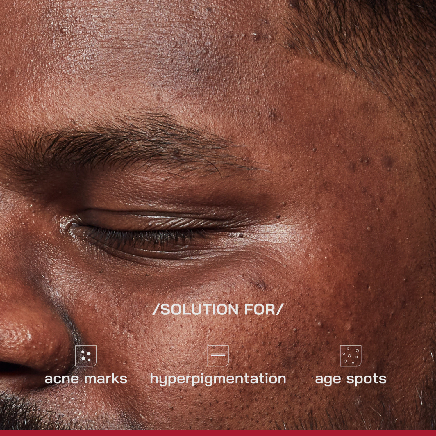 Image of Proven Honest Derma /PHD / 2% Alpha Arbutin Depigmentation Serum with 2% Tyrobright