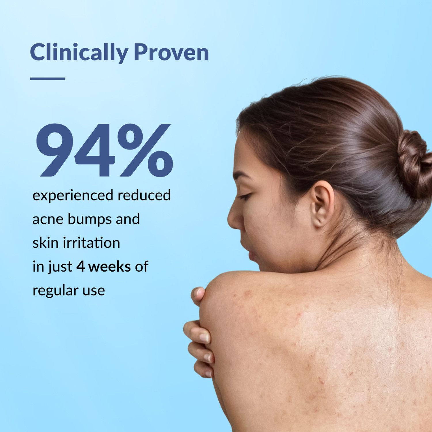 Image of Fixderma 2% Salicylic Acid Salyzap Body Acne Spray For Acne on Back, Shoulders & Chest