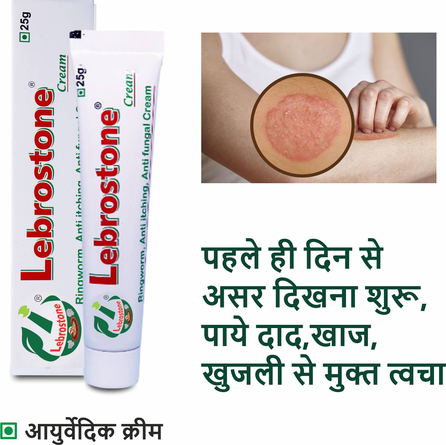 Lebrostone Ayurvedic Skin Cream 100g Pack of 4 · 25 g (100 g total) - Image 4
