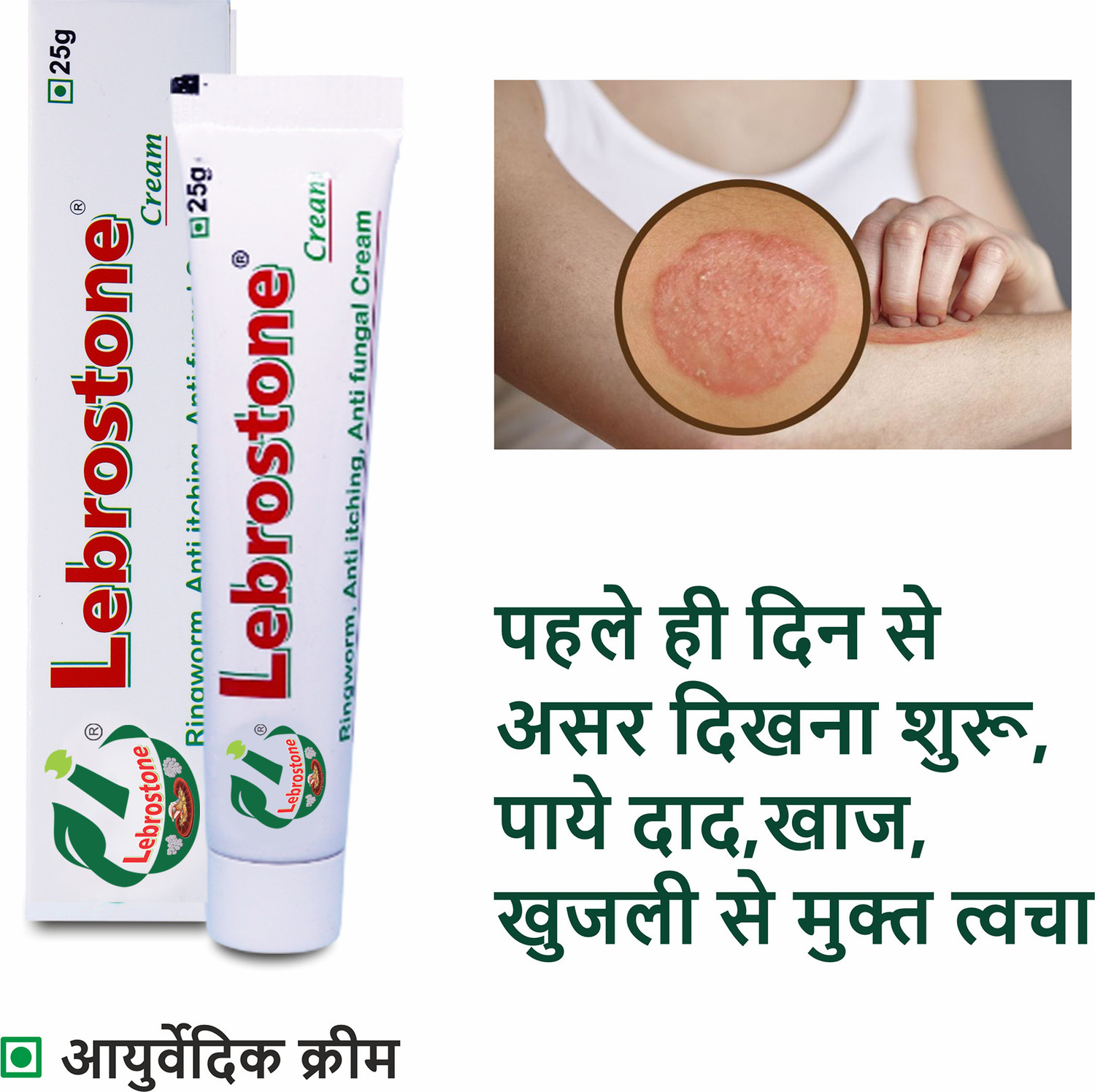 Image of Lebrostone Ayurvedic Skin Care Treatment Cream 25g - For Ringworm, Itching & Fungal Infections (Pack of 6)
