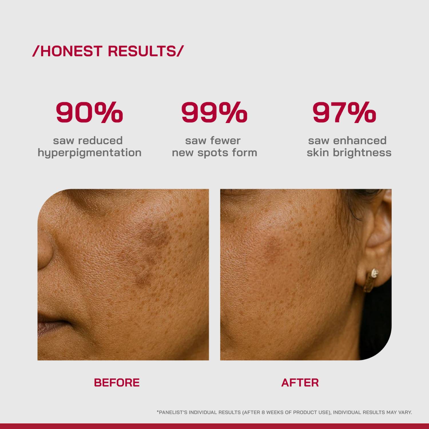 Proven 2% Alpha Arbutin Depigmentation Serum - Image 4