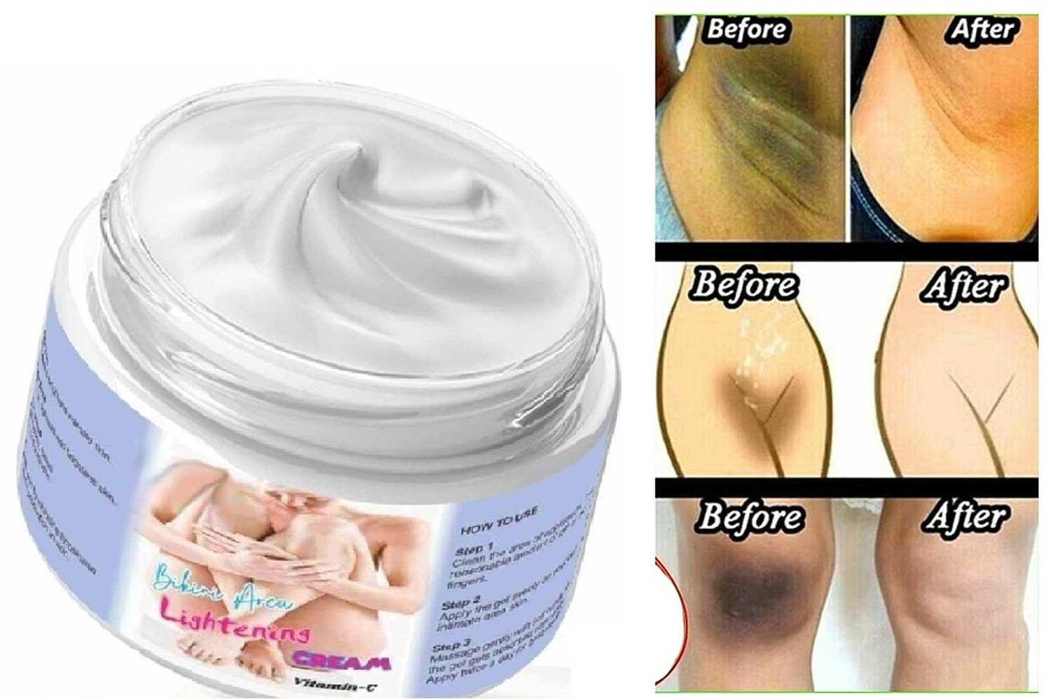 Image of AFARAXIA Women Intimate area Skin Lightening Cream | Best Whitening Cream for Intimate