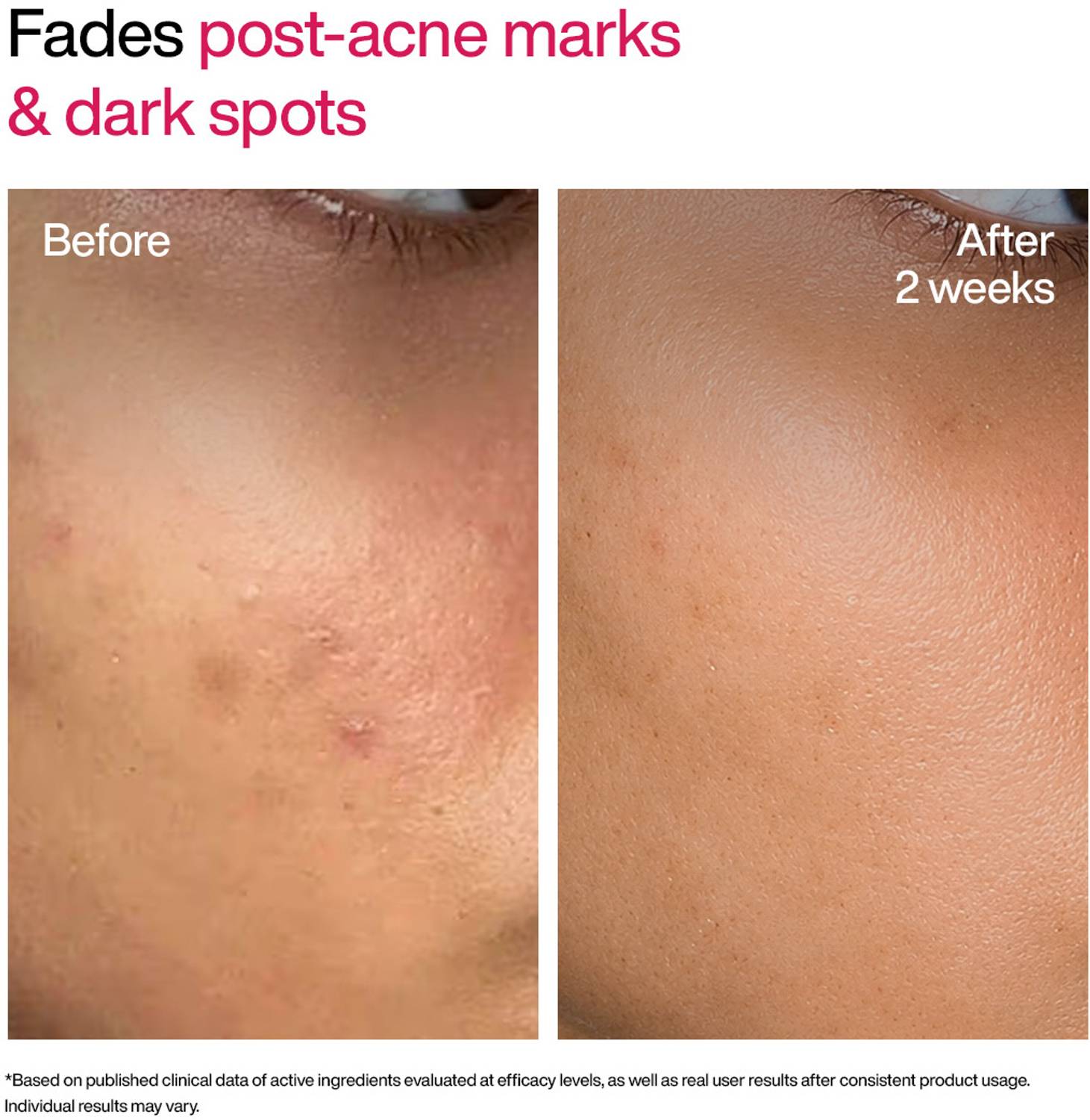 WishCare Advanced Dark Spot TXA Shot - Image 2