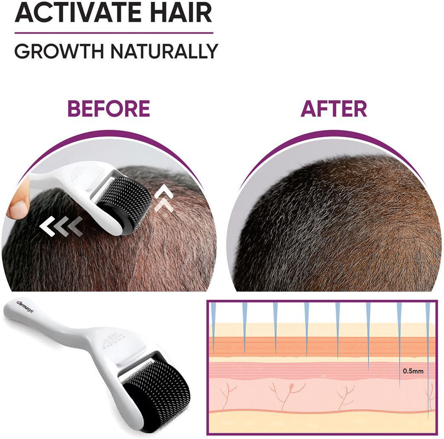 Image of Dermasys Derma Roller for Hair Growth 0.5mm with 540 Titanium Needles for Men & Women