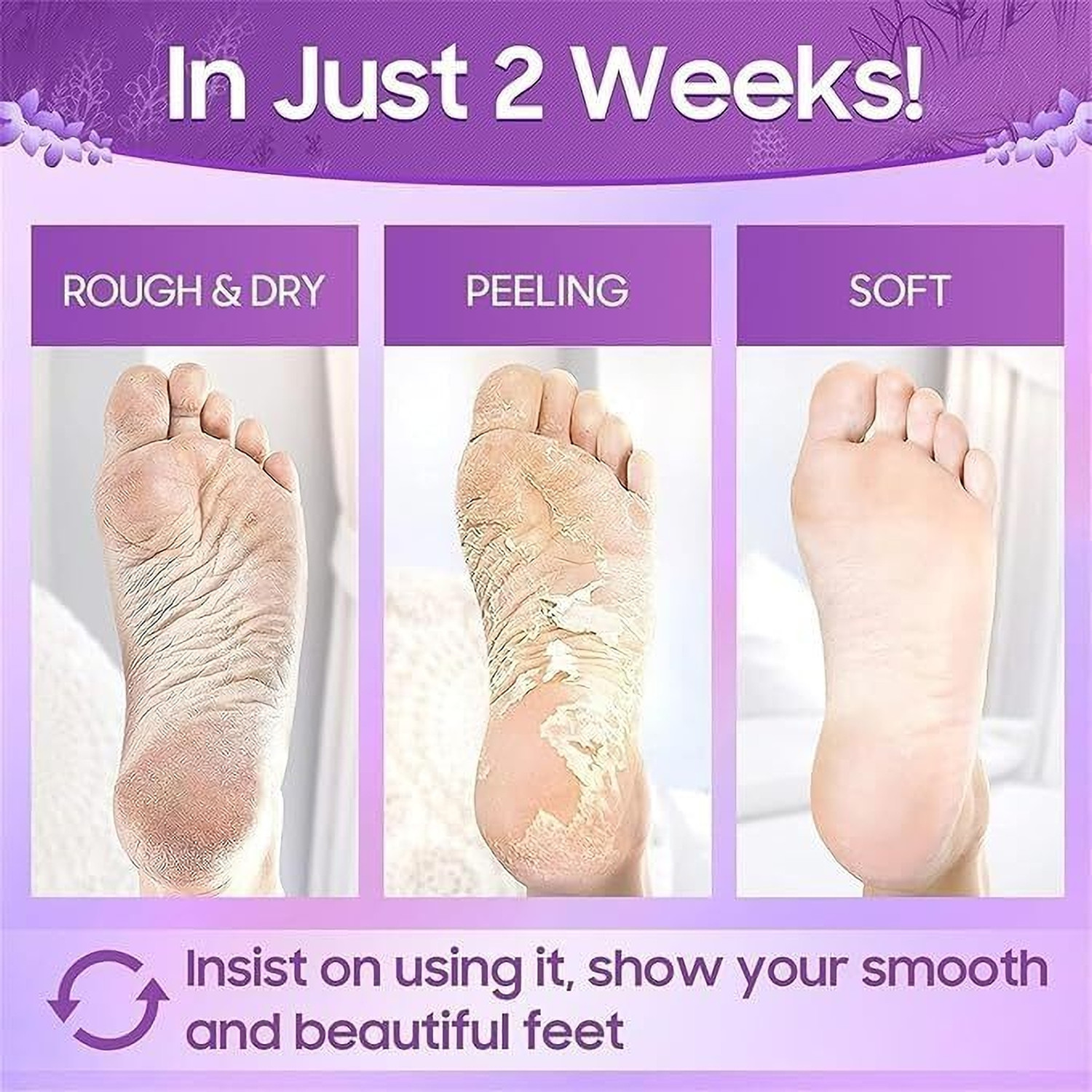 Image of SHRUSTAM Advanced Foot Peel Therapy - Remove Calluses & Repair Dry Heels