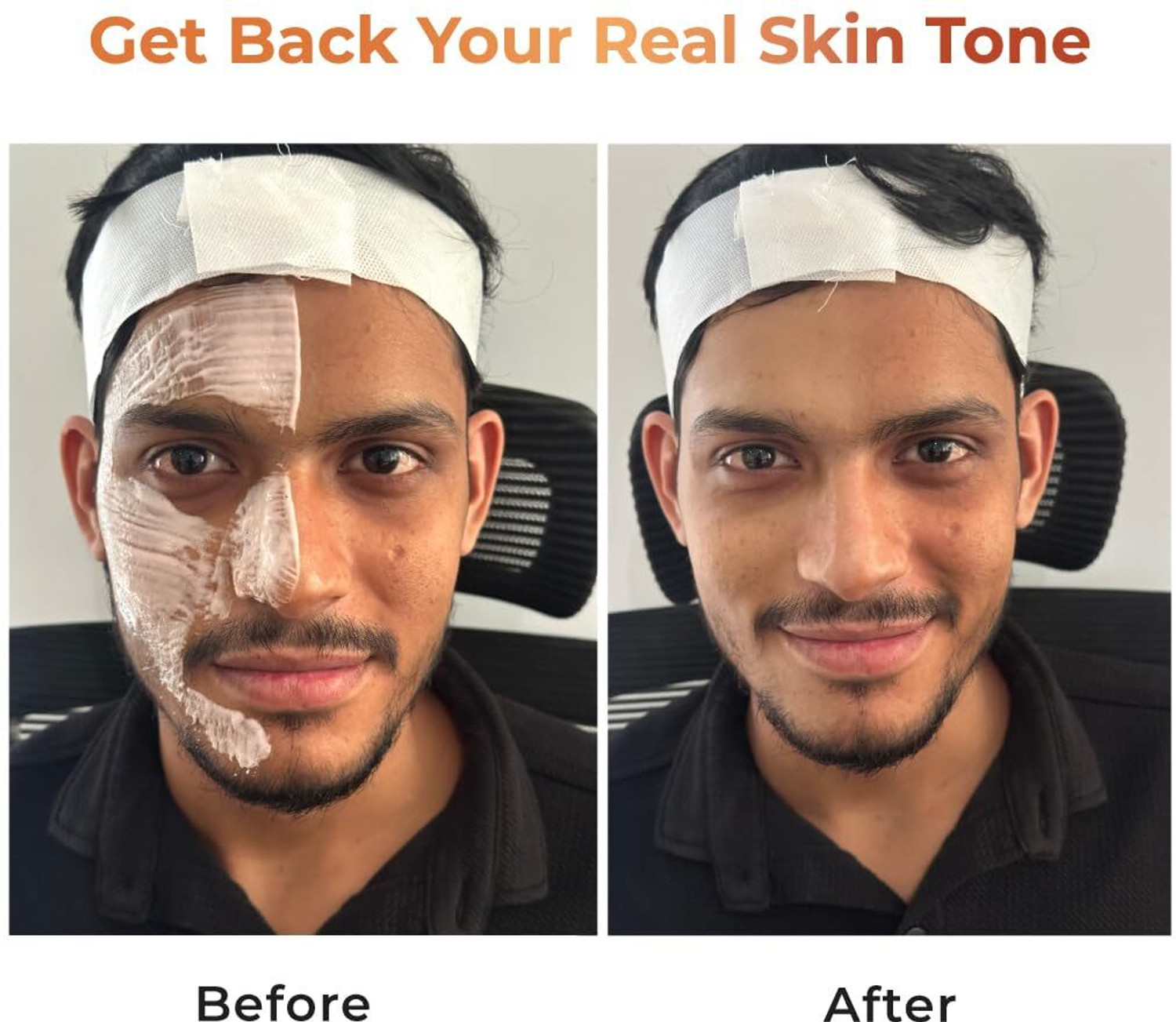 Image of NEECONI 8. Tan Removal Gluta Kojic Cream for Clear Even Skin