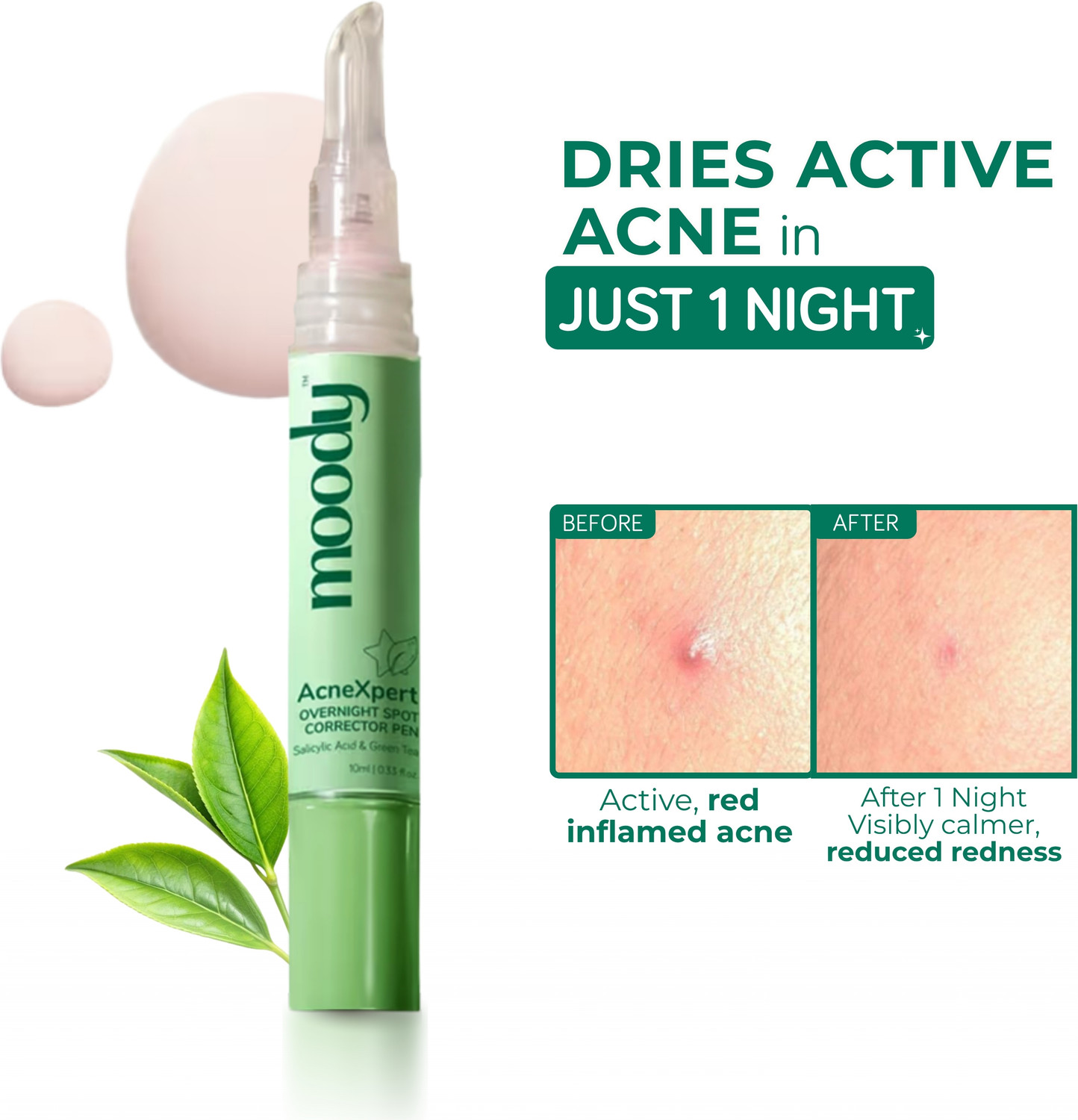 Image of MOODY Acnexpert Overnight Spot correcting pen with Salicylic acid and Green tea