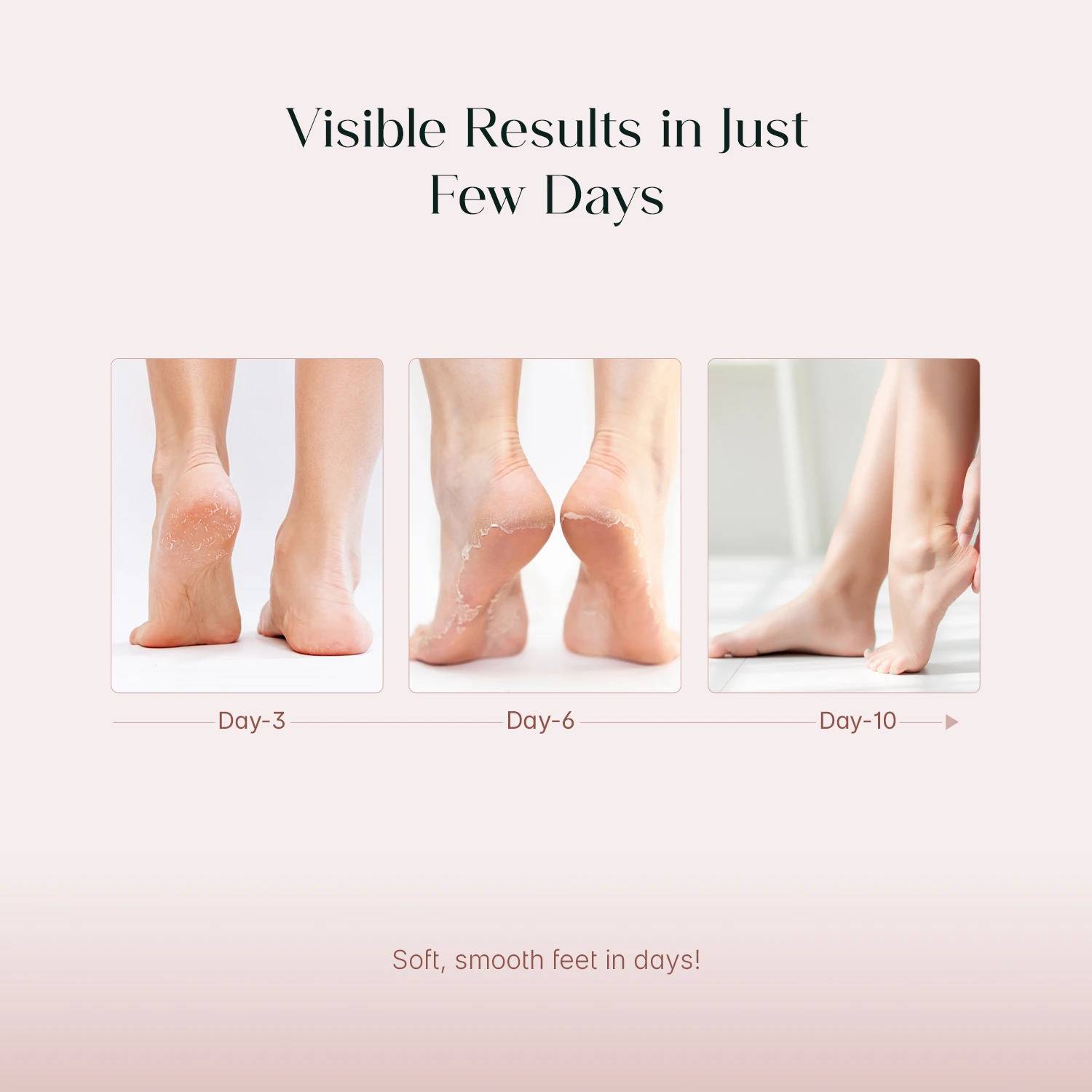 Seoulskin Glycolic Acid Foot Peeling Mask - Image 4