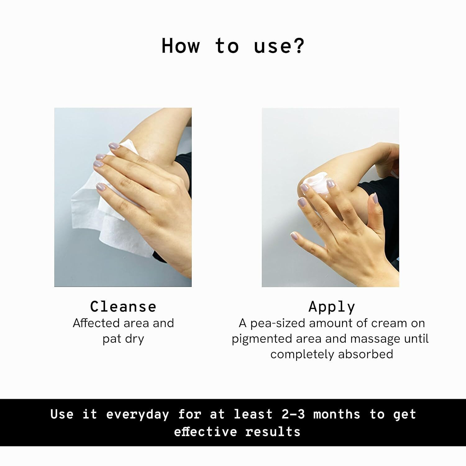 Image of Be Bodywise Pigmentation Repair Cream | Treats Dark Spots & Tan | Daily Use Body Lotion