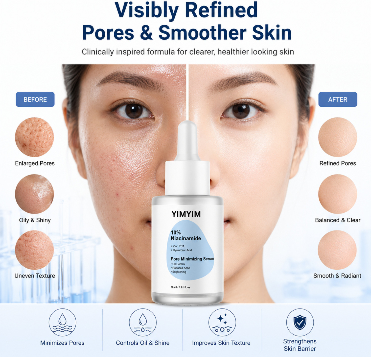 Image of YIMYIM 10% Niacinamide Face Serum with Zinc PCA & Hyaluronic Acid | Pore Minimizing, Oil Control, Acne Reducing & Brightening Serum