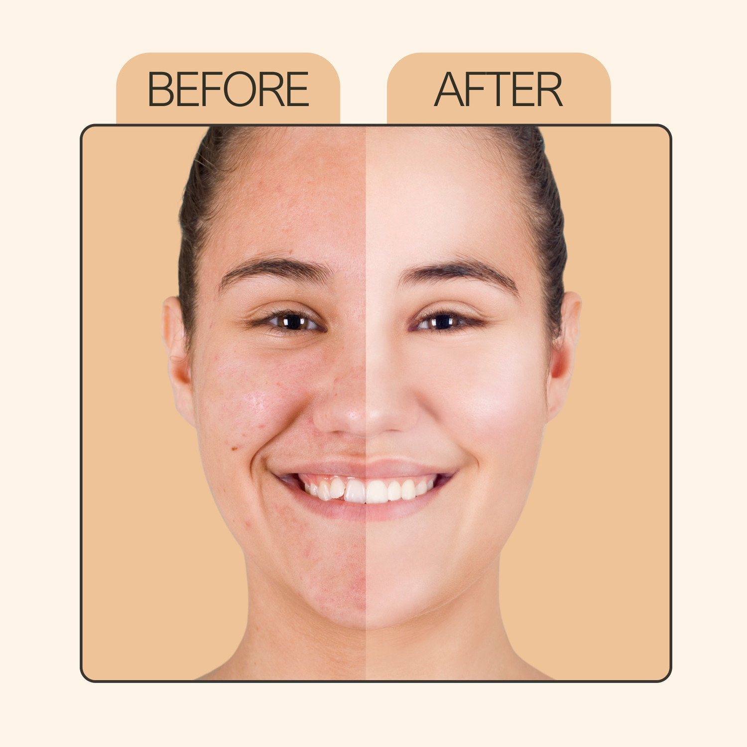 Image of DermaTreat Essentials 10% Vitamin C Face Serum with Niacinamide & Hyaluronic Acid | Reduces Dark Spots & Treats Pigmentation | For Glowing Skin
