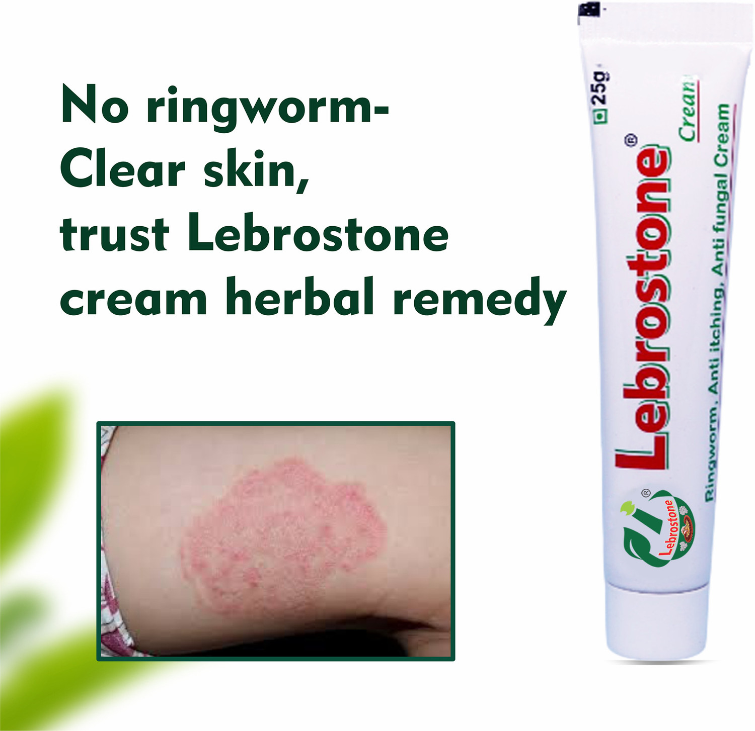 Image of Lebrostone Ayurvedic Skin Care Treatment Cream 25g - For Ringworm, Itching & Fungal Infections (Pack of 6)