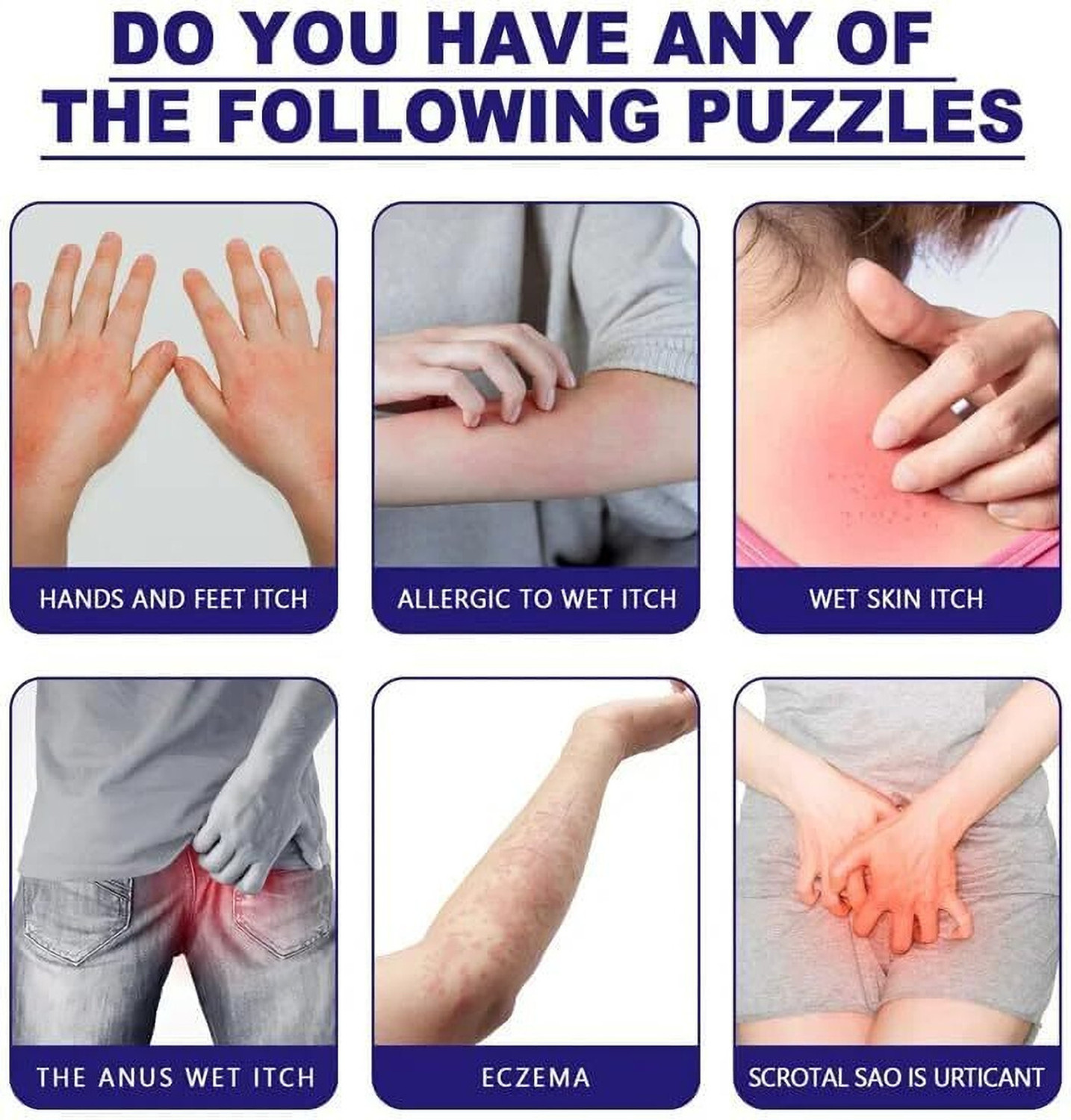 Image of Ontario ECZEMA CREAM MEN & WOMEN AX4.40 (PACK OF 1)