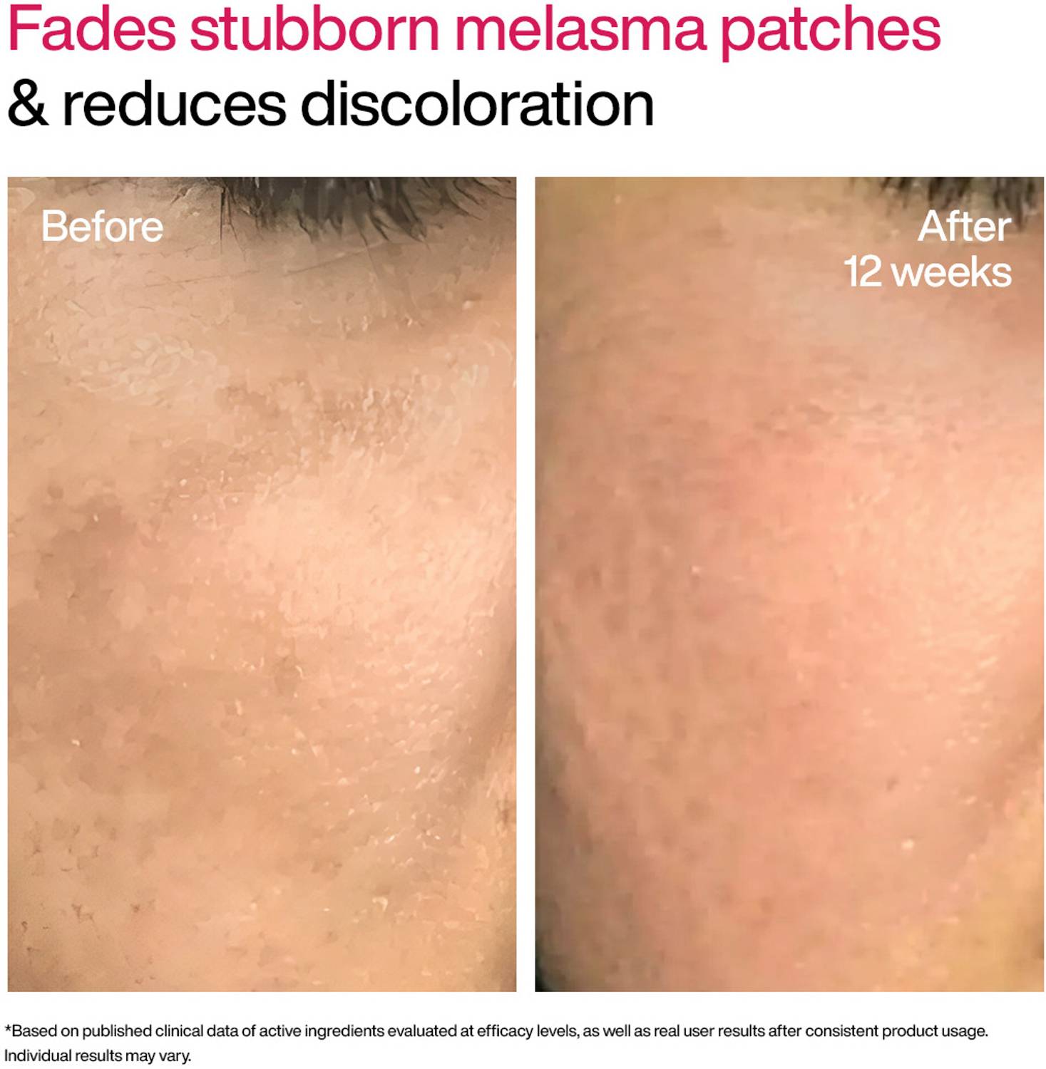 WishCare Advanced Dark Spot TXA Shot - Image 4