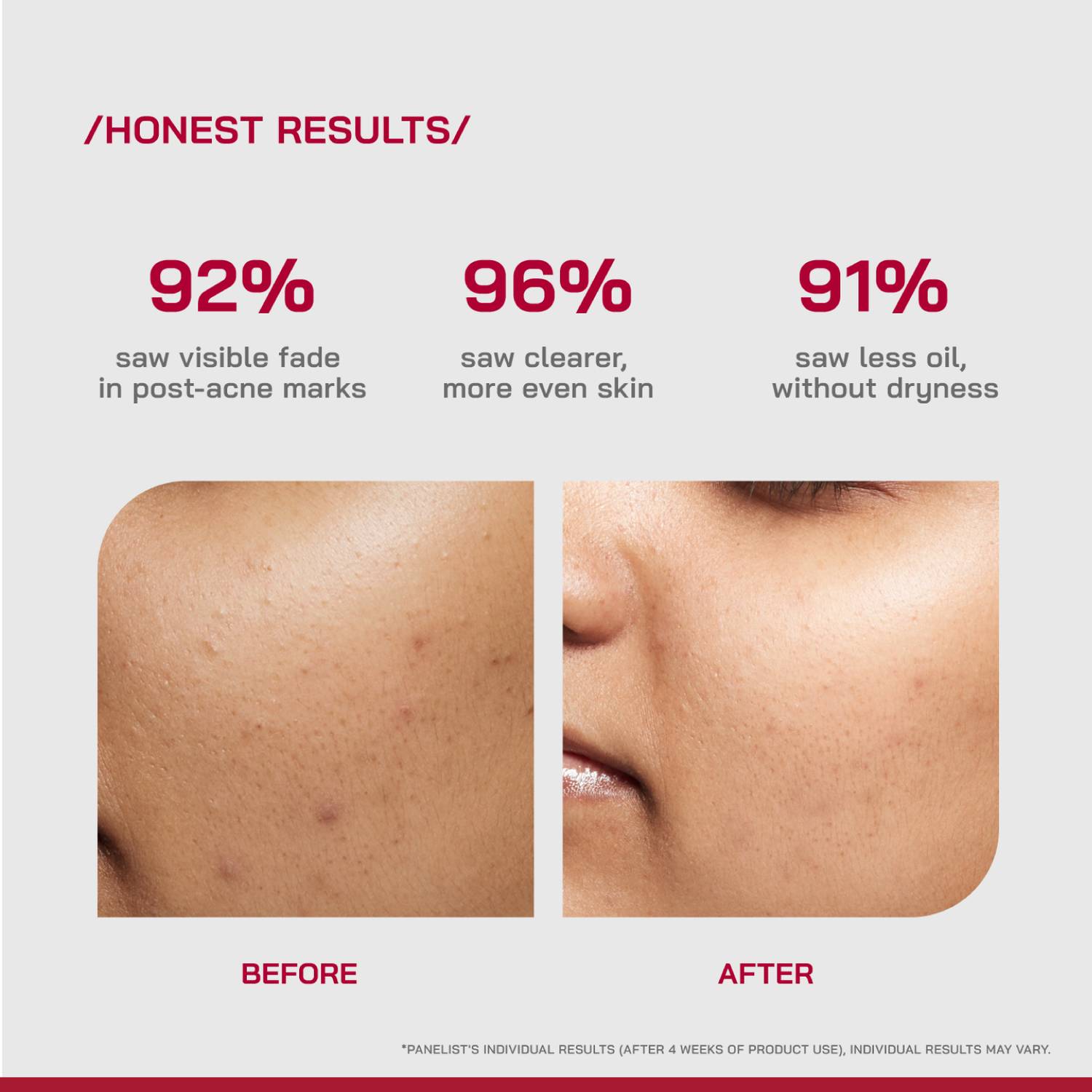 Proven 10% Niacinamide Spot Correcting Serum 2% NAG - Image 4