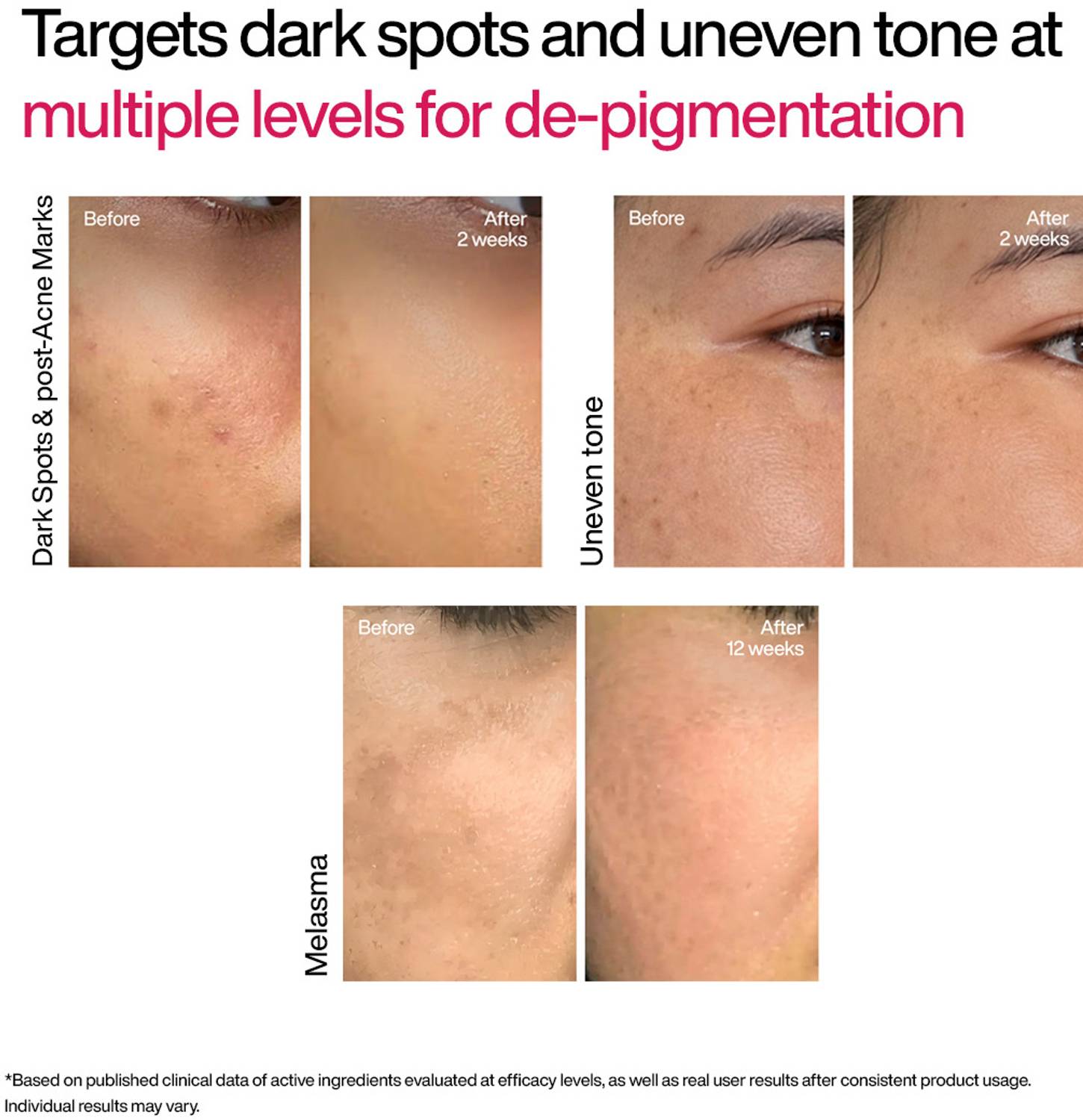 WishCare Advanced Dark Spot TXA Shot - Image 5
