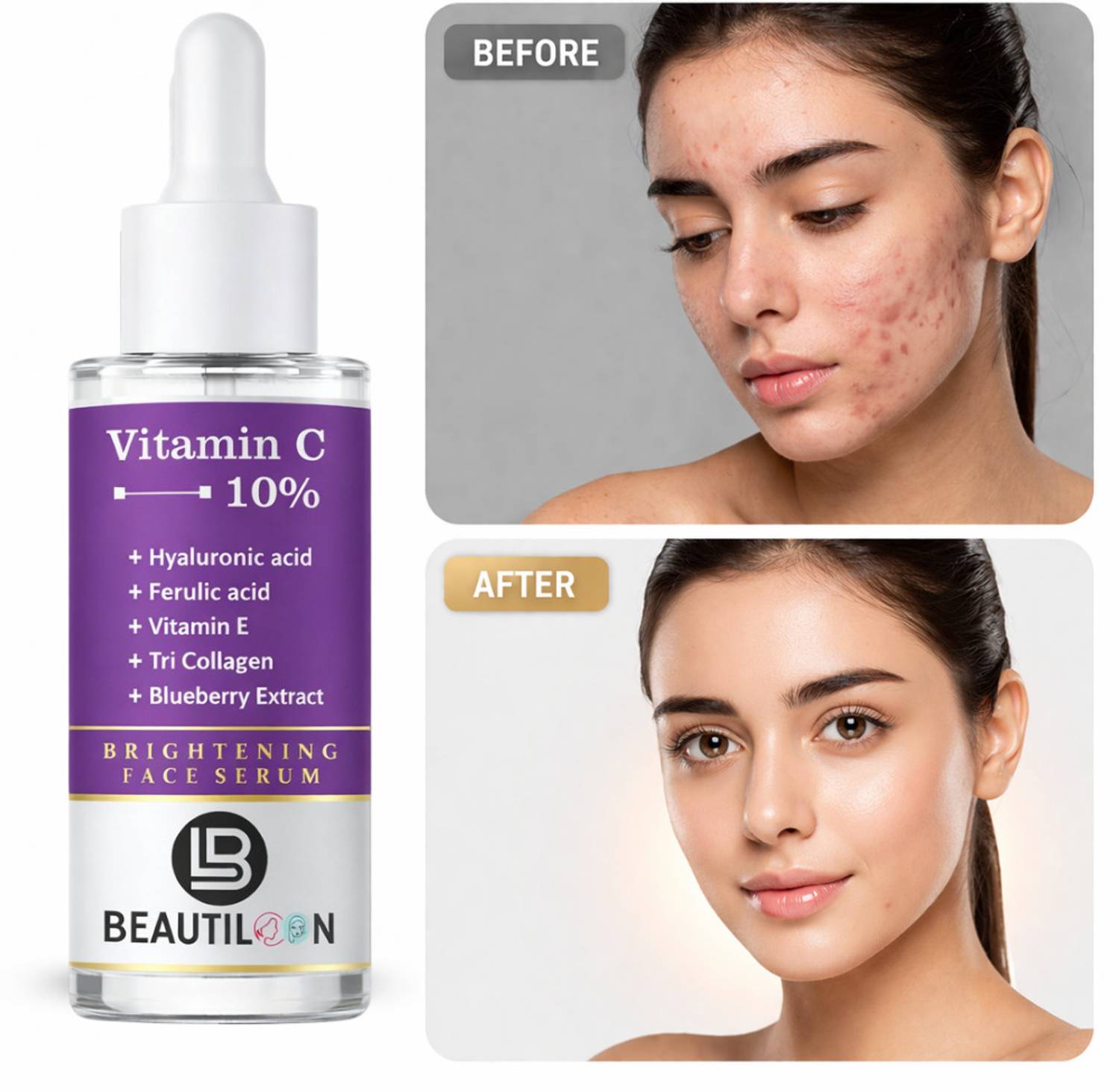 beautiloon Vitamin C Serum for Skin Brightening and Hydration with Hyaluronic Acid, Vitamin E and Ferulic Acid for Dark Spots Removal and Smooth Skin Texture
