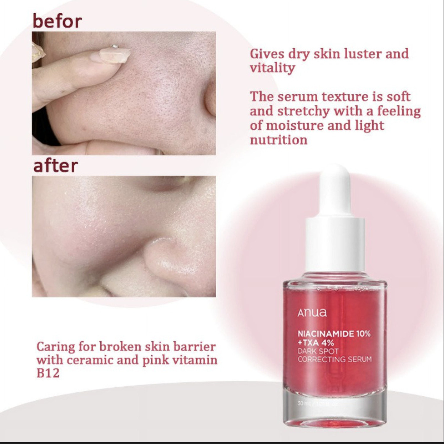 Image of ANUA Ultra-Light Brightening Serum, Niacinamide + TXA Formula for Dark Spots, Hydration & Glass Skin Glow