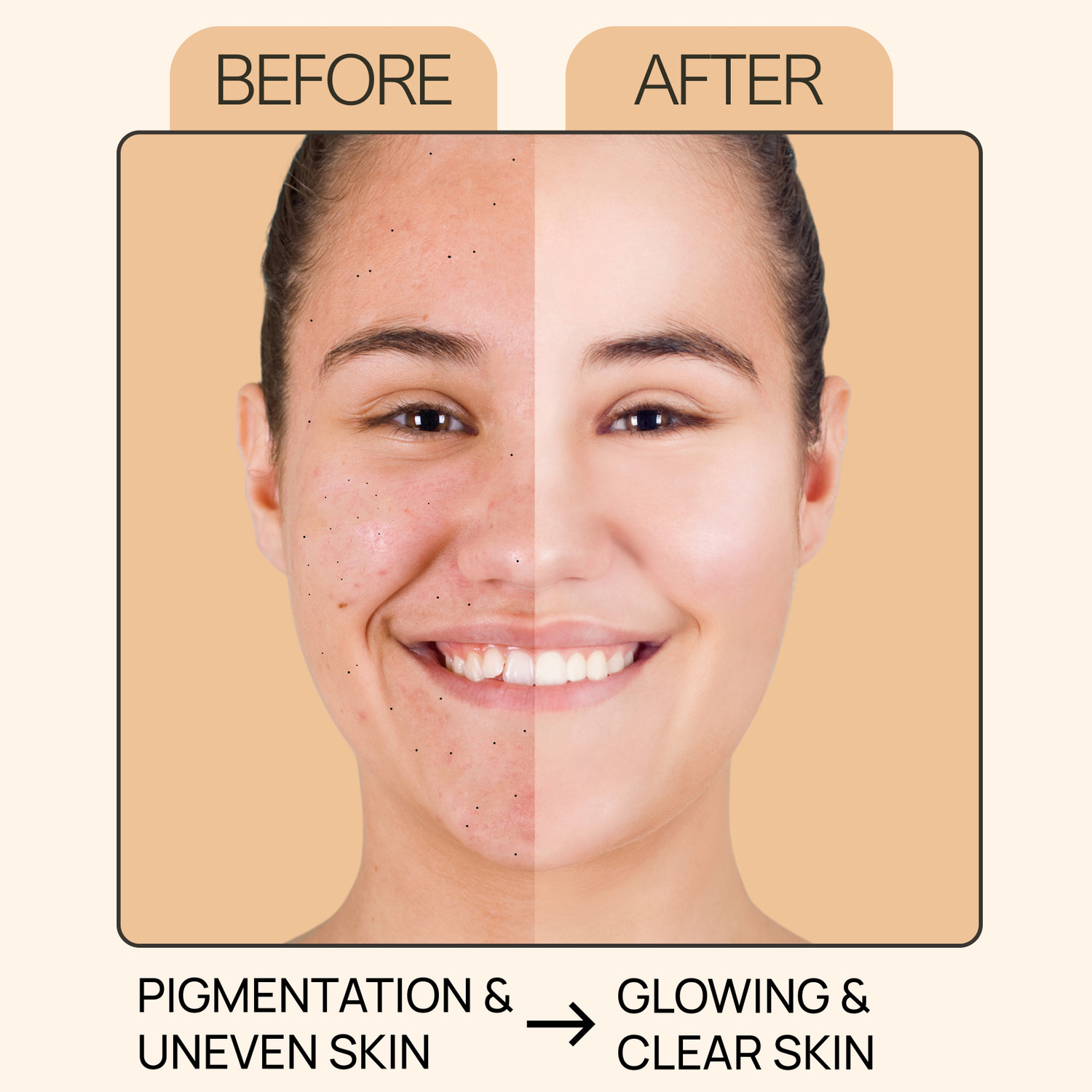 Image of DermaTreat Essentials DermaTreat Essentials 10% Vitamin C Face Serum with Niacinamide & Hyaluronic Acid | Reduces Dark Spots & Treats Pigmentation | For Glowing Skin