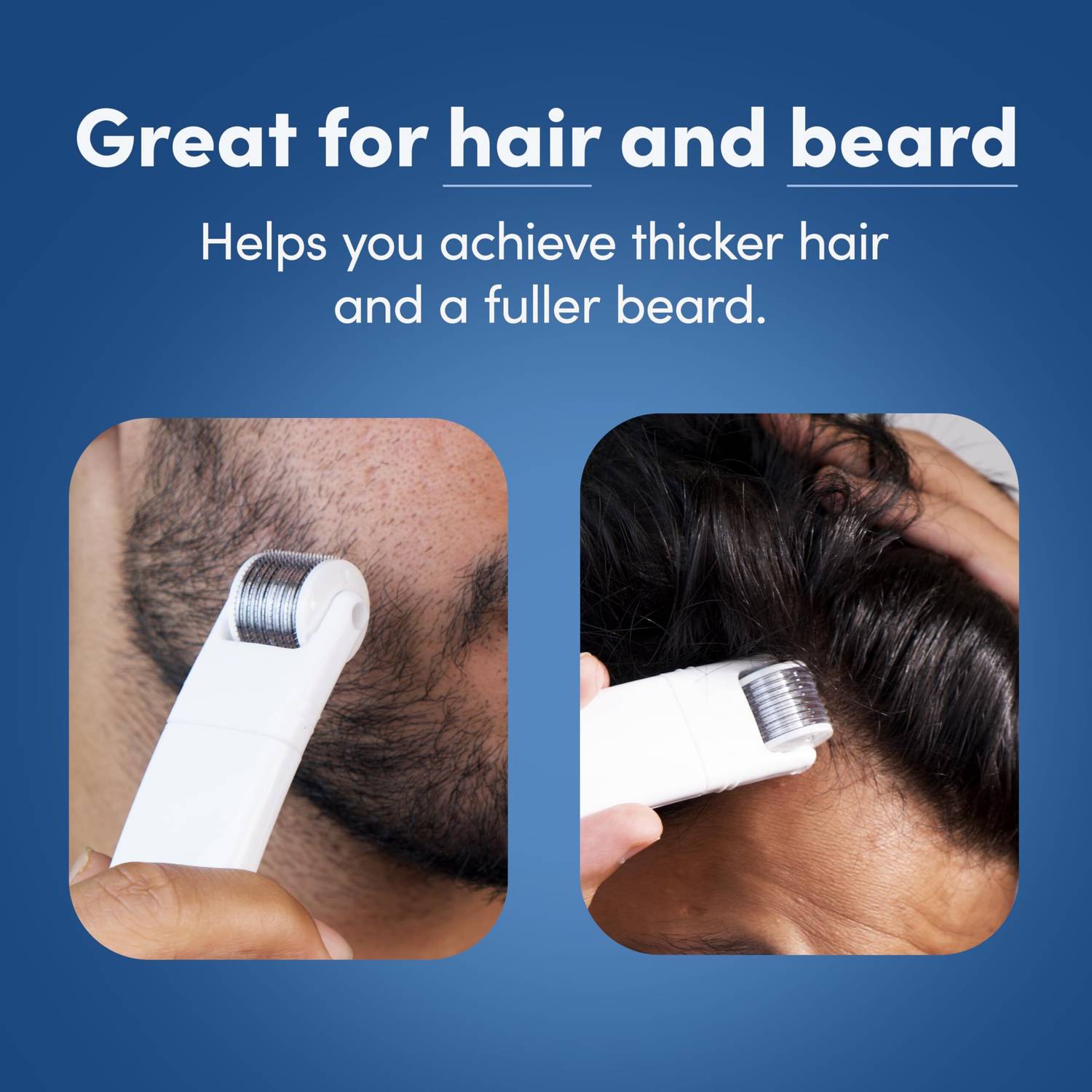 Man Matters 2-In-1 Derma Roller 0.5mm - Image 3
