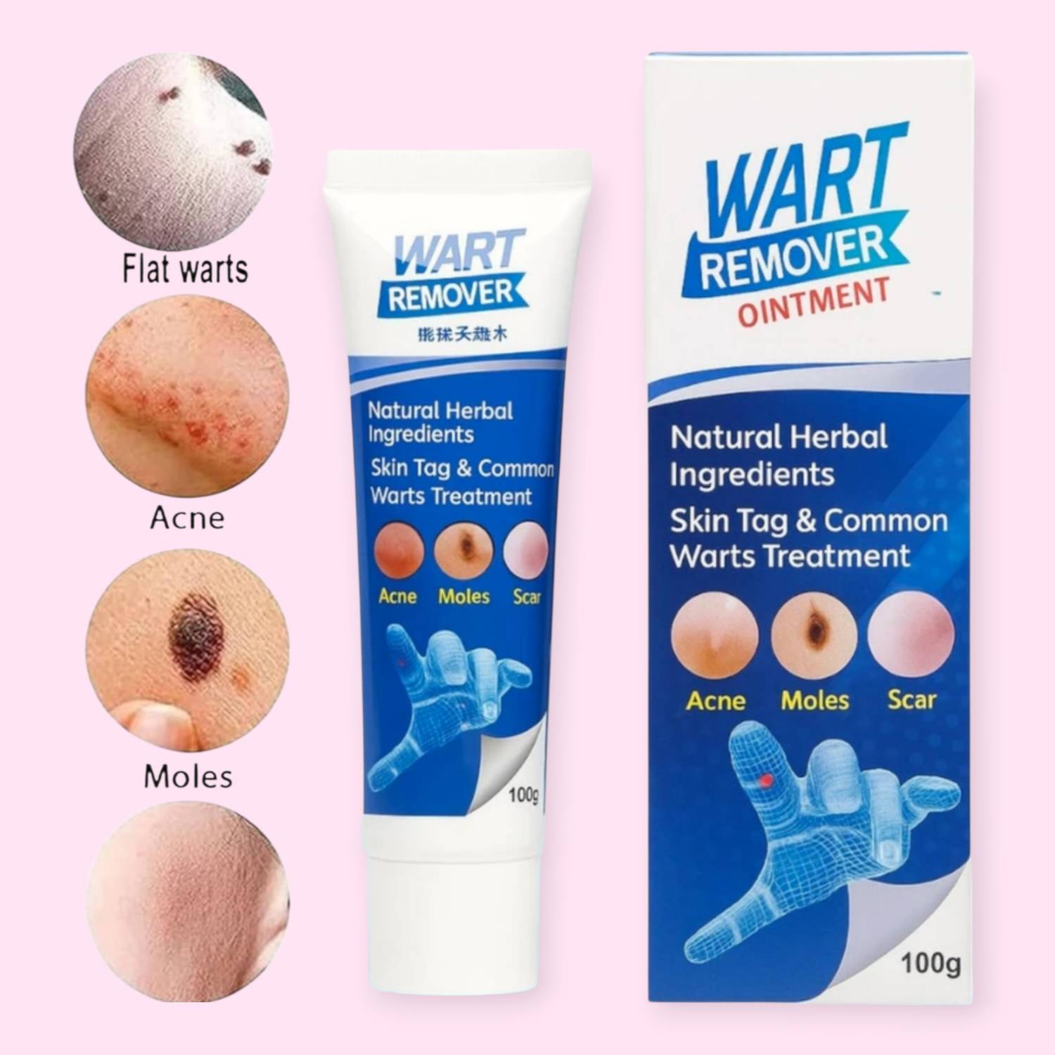 Vana Glow Wart Remover Cream with Herbal Skin Support 100g