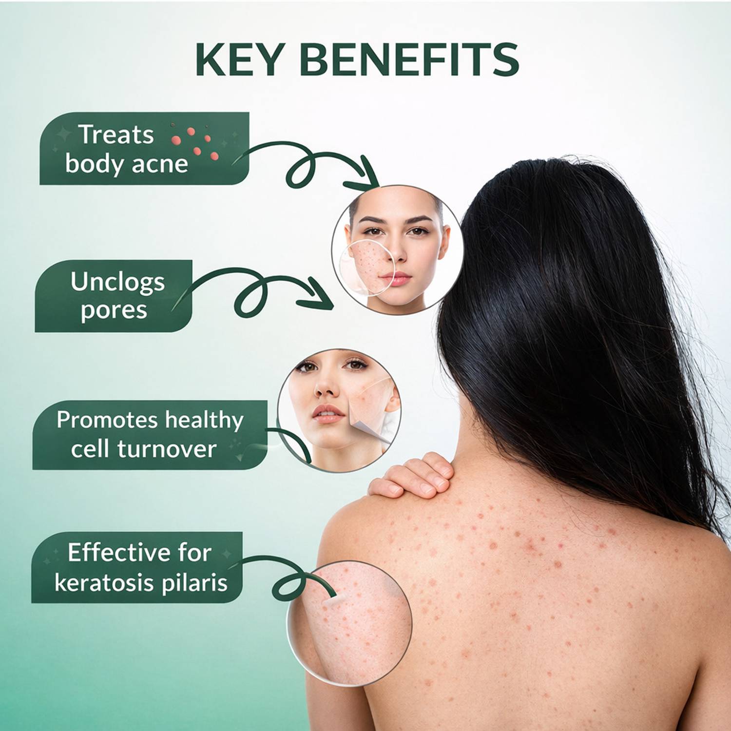 Skinlure Anti Acne Spray 2% Salicylic Acid - Image 2