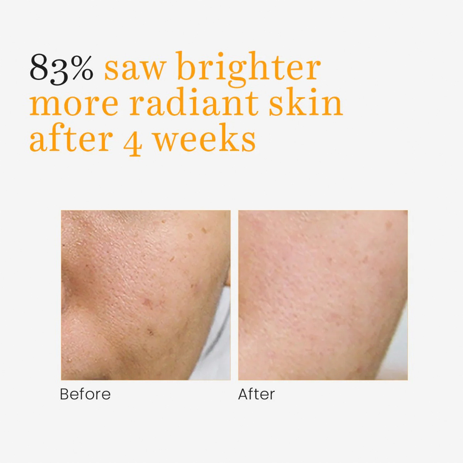 Image of O3+ Vitamin C Serum Glow with Glycolic Acid For Reduces Dark Spots & Pigmentation