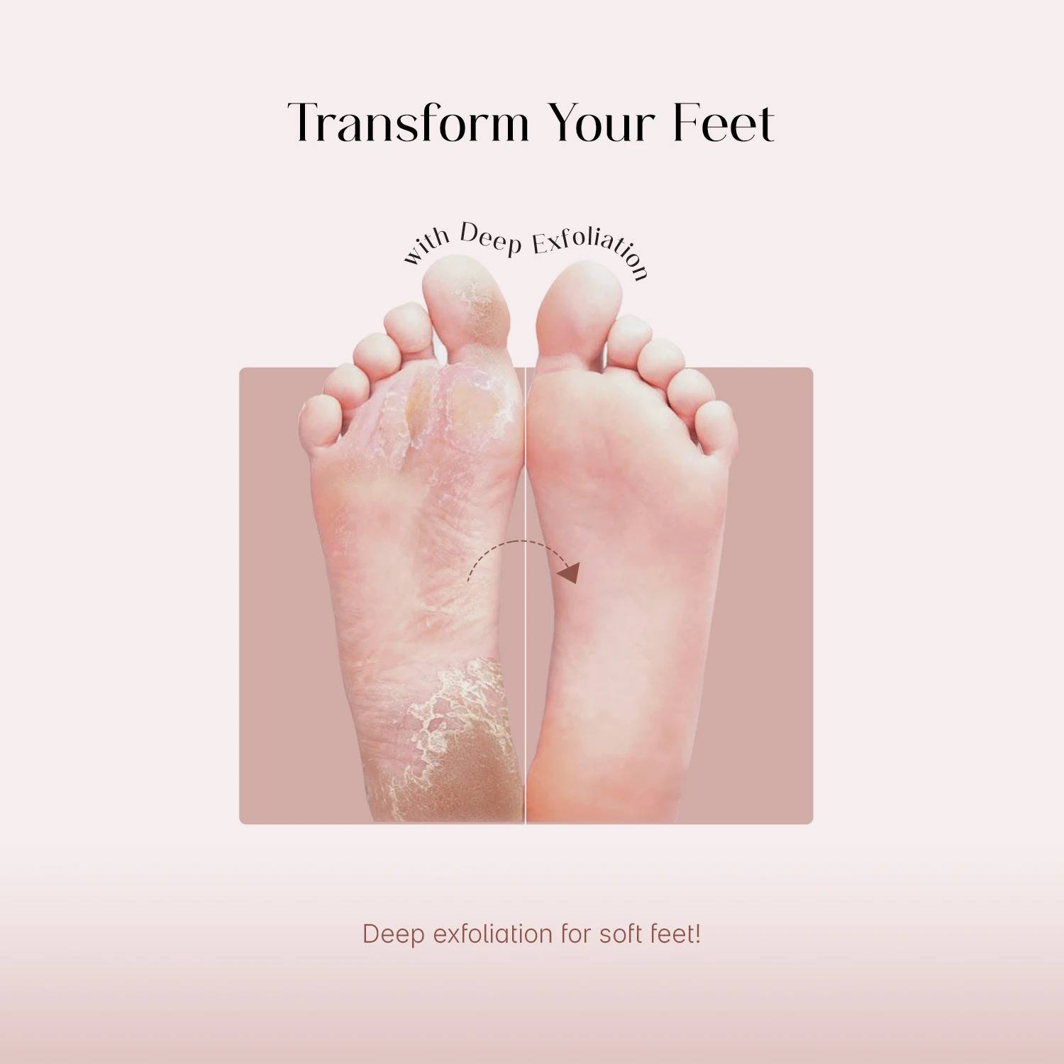 Seoulskin Glycolic Acid Foot Peeling Mask - Image 2