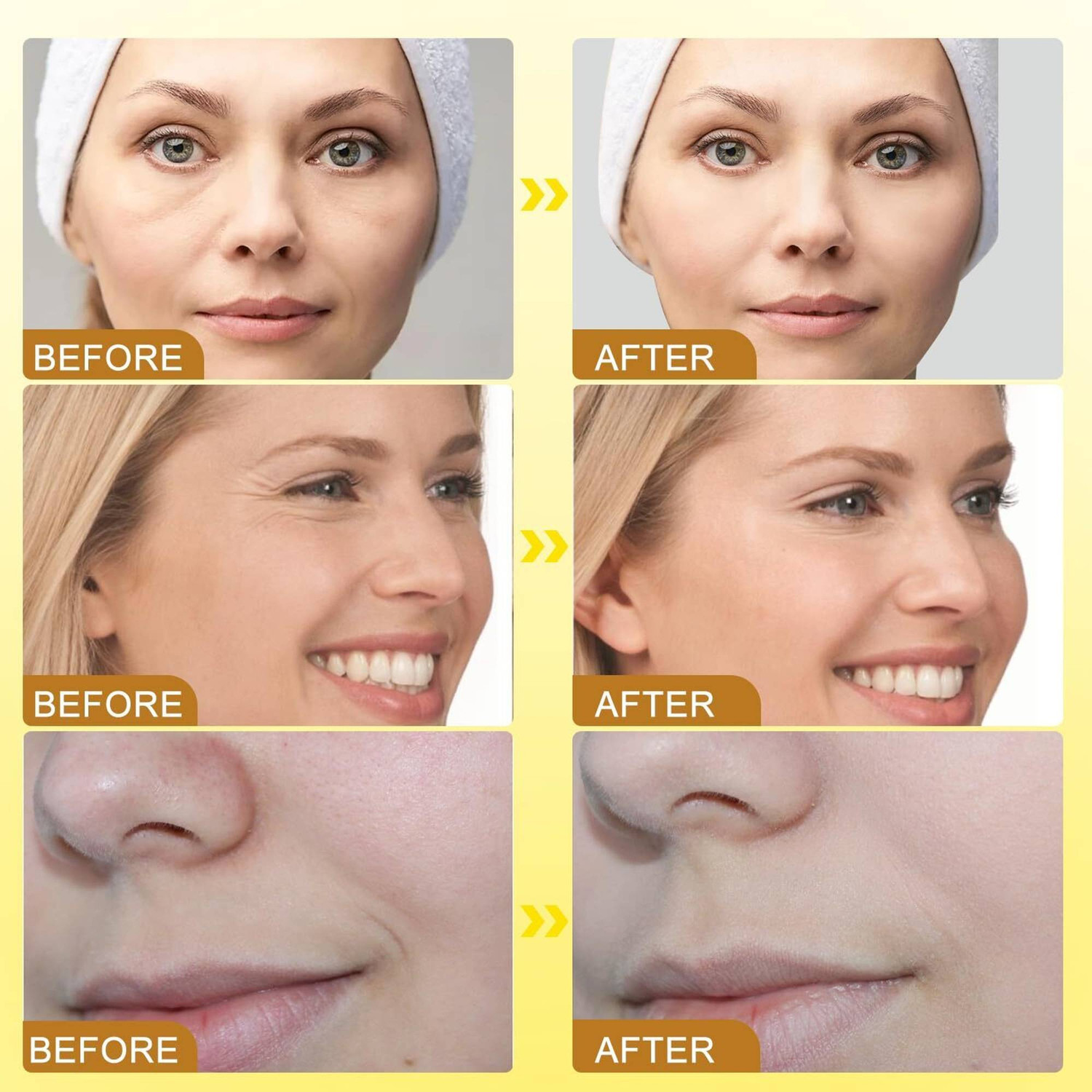 Image of BRINEXA Bee Venom Anti Aging Cream for Face Tightness 134 (100 g)