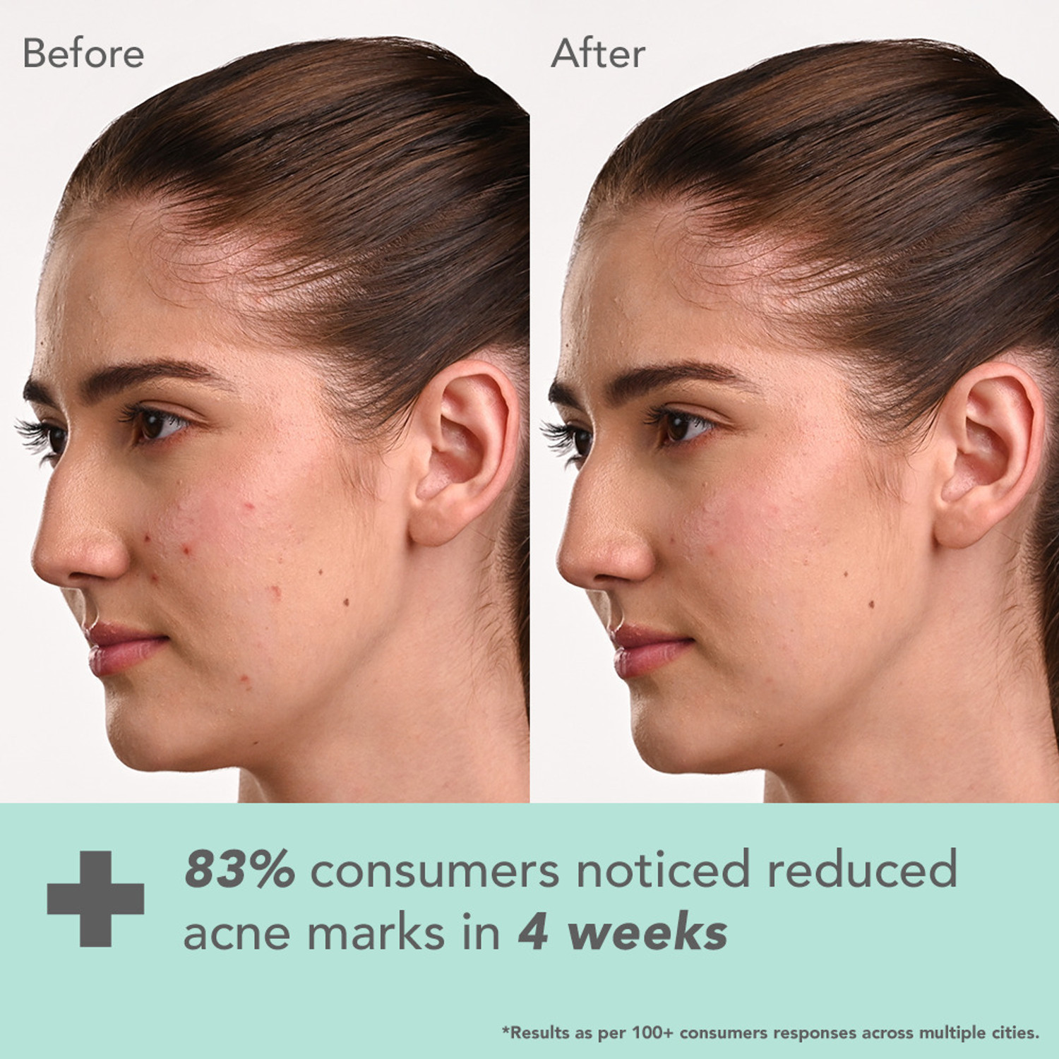 Image of LOTUS DERMA BOTANICS Hi-Dose Serum Kojic Acid + Multi Berry | Reduce Pigmentation |For Sensitive skin