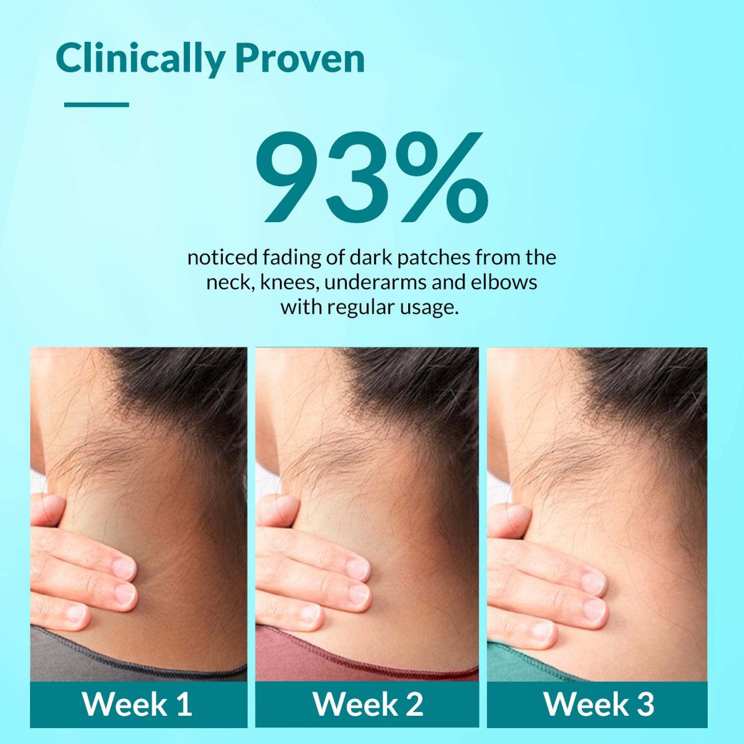Fixderma Nigrifix Cream For Dark Skin Areas - Image 5