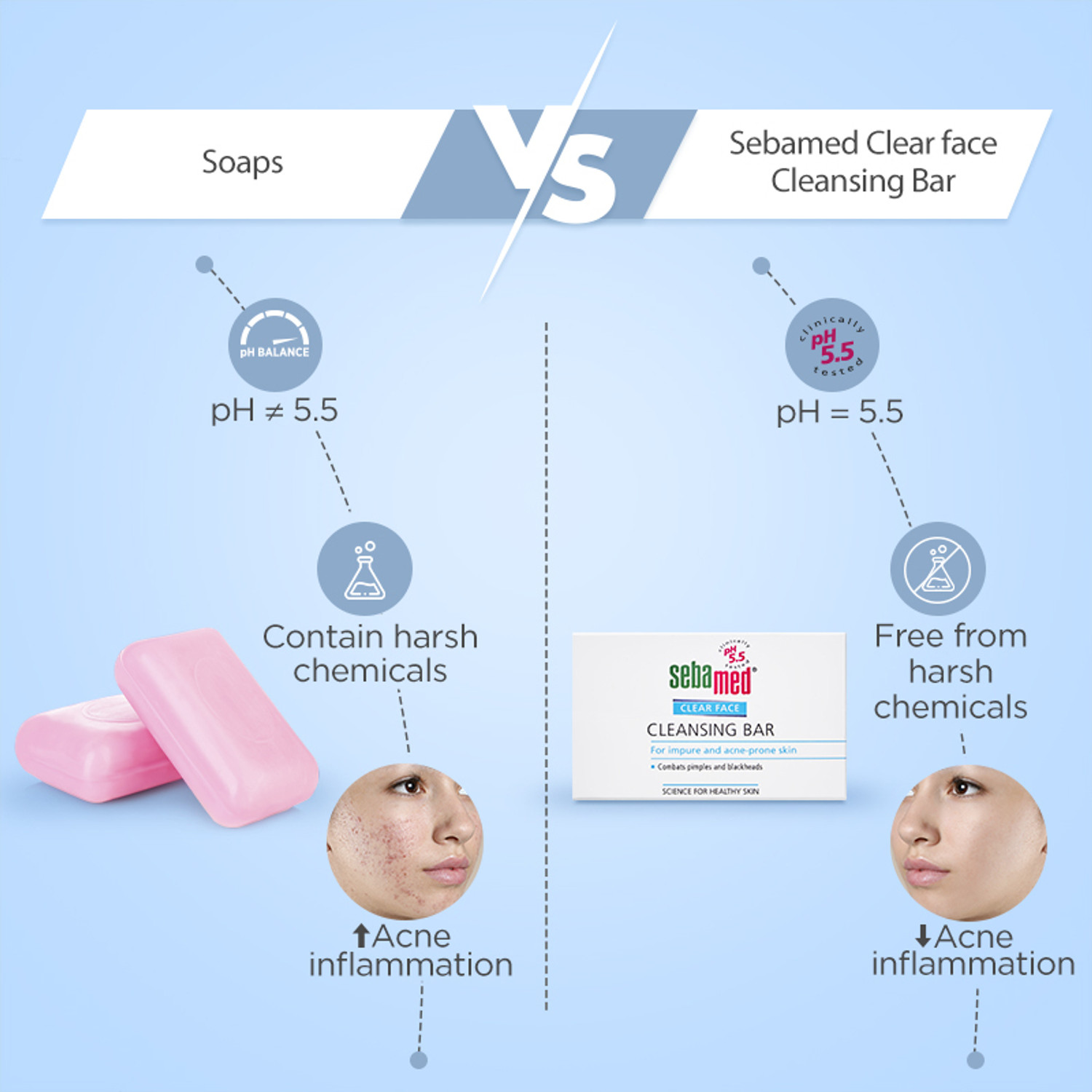 Image of Sebamed Clear Face Cleansing Bar| pH 5.5 |Gentle & deep pore cleansing |