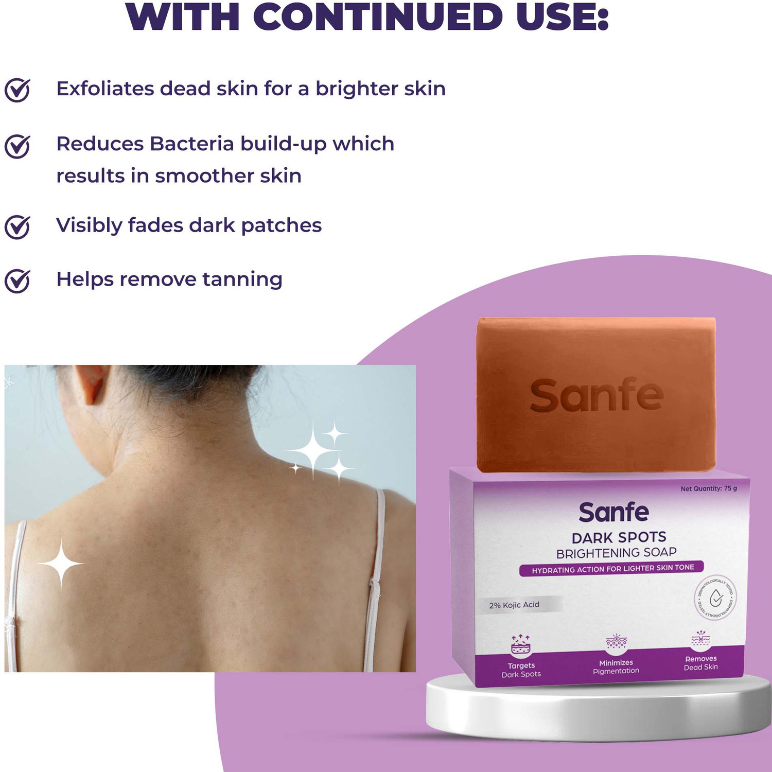 Image of Sanfe Dark Spots Brightening Soap |2% Kojic Acid & Glutathion| Prevents New Blemishes
