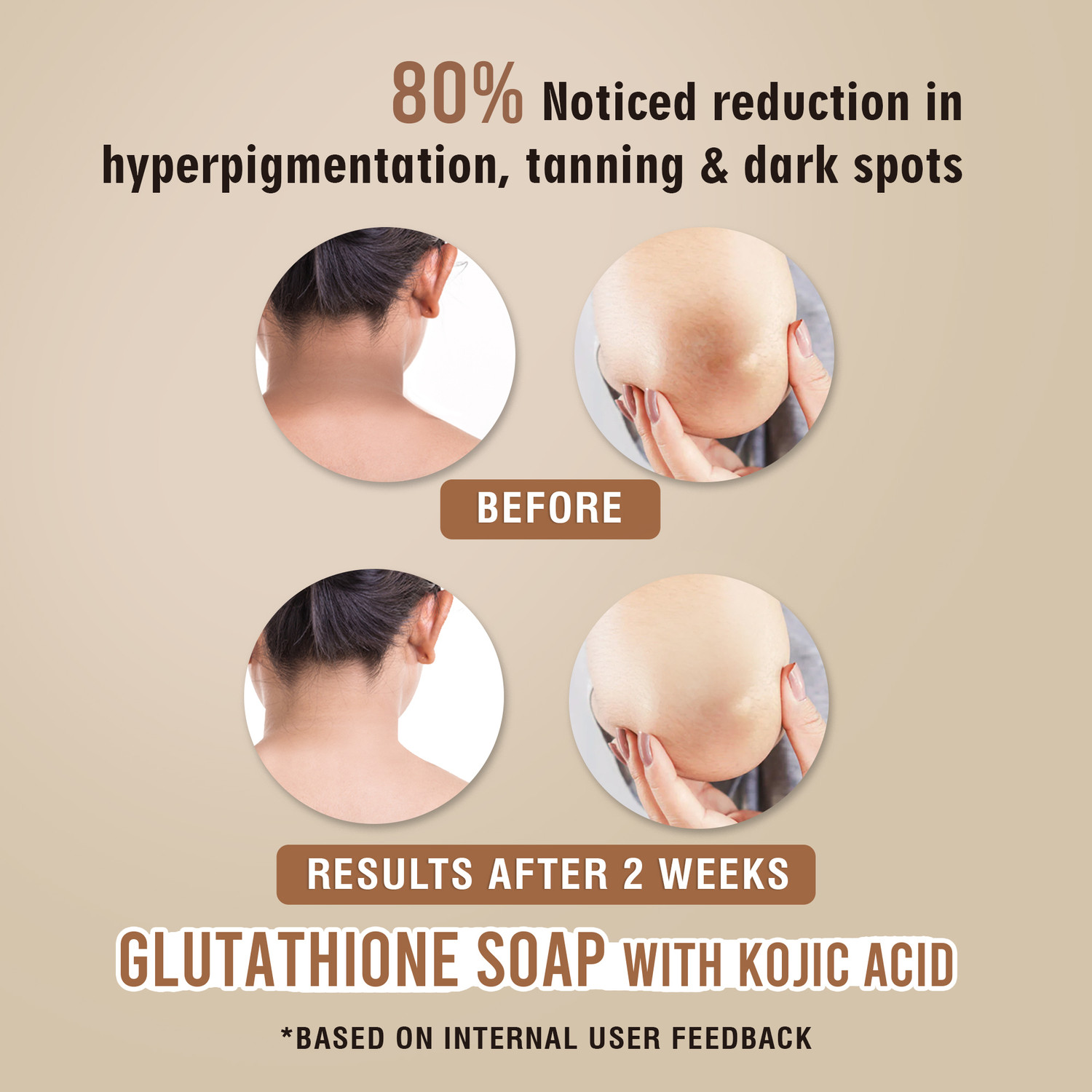 Image of GLAMVEDA Glutathione & Kojic Acid Soap|Lightens Dark Spots,Acne Scars & Hyperpigmentation