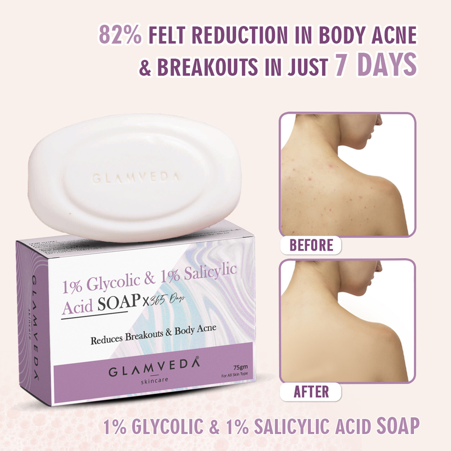 Image of GLAMVEDA Skin Lightening Glycolic & Salicylic acid soap | Reduces Blackheads & Excess Oil