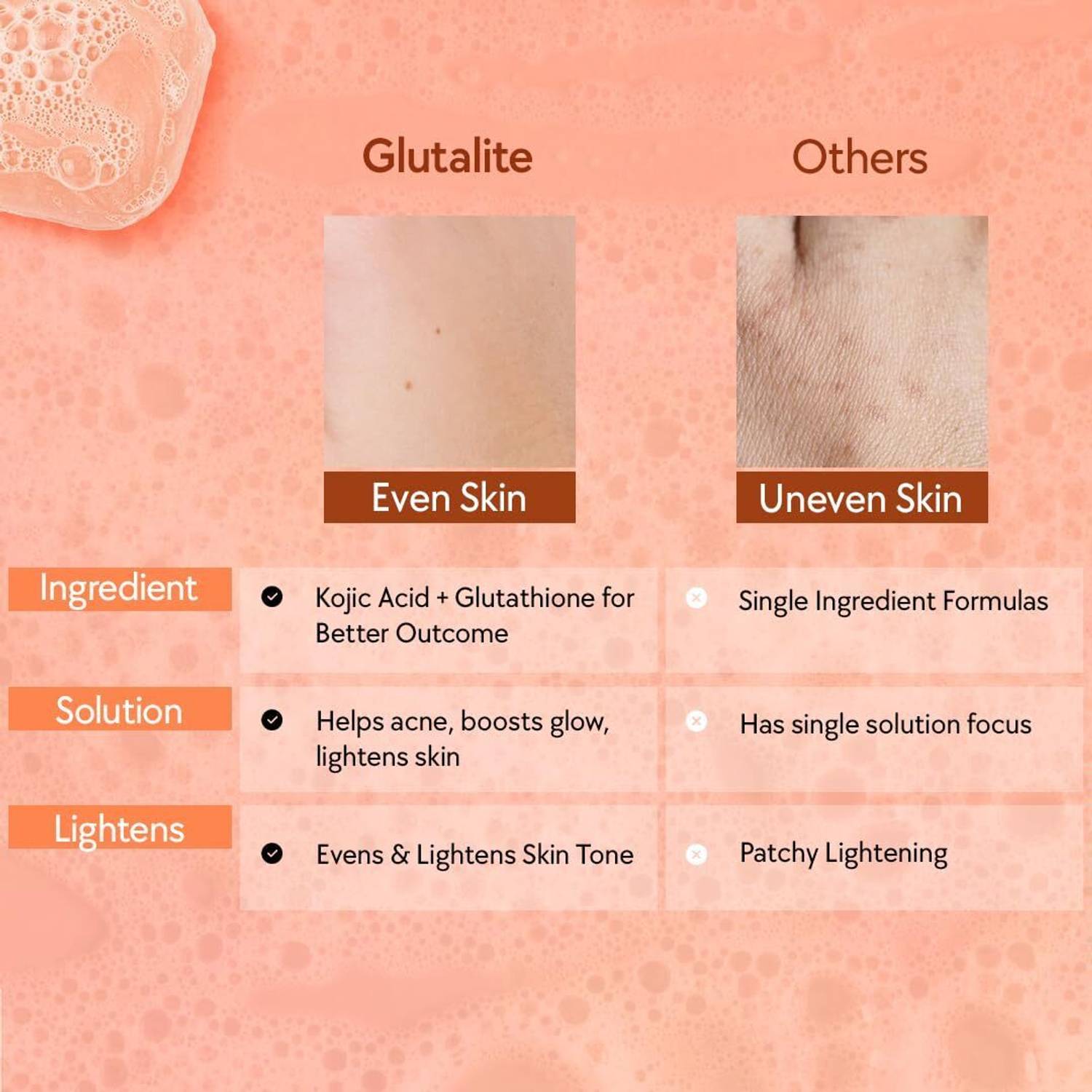glutathione vs kojic acid which is better for skin whitening or Glutalight Glycerin Brightening Soap with Nourishment The glutathione soap contains ✨ Reveal Your Most Fijne Lijntjes / Rimpels Size:250 mL – wrinkles and pore size Global Health Bundle:2 Boxes Glutathione IV Drip Therapy