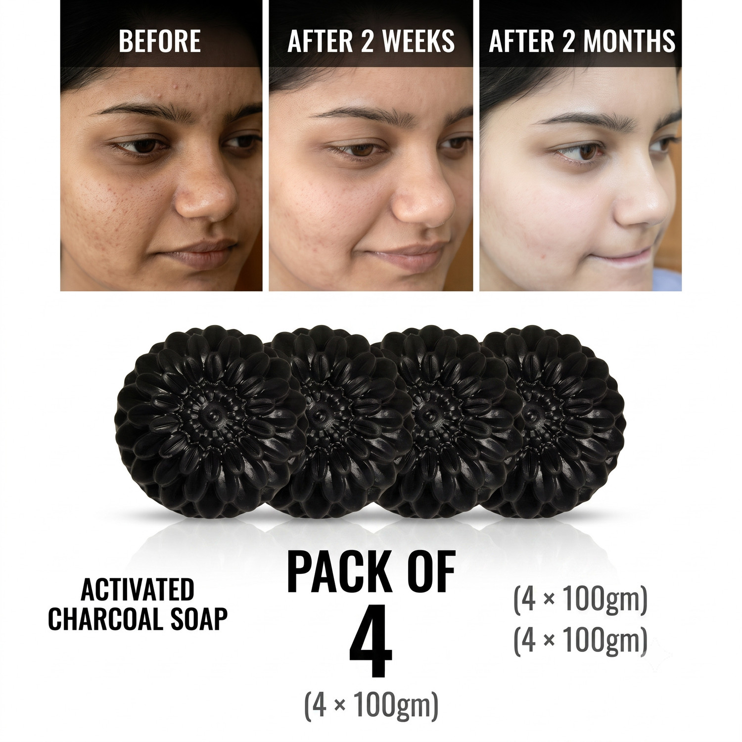 Image of Chhaydo Herbal Gharss Lemon Charcoal Soap | Oil Control & Deep Cleansing Bath Bar Soaps