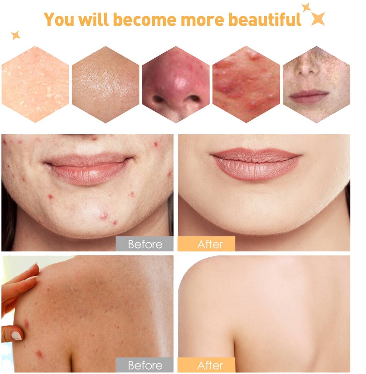 satroopaa Sandalwood Soap for Glowing Skin - Image 4