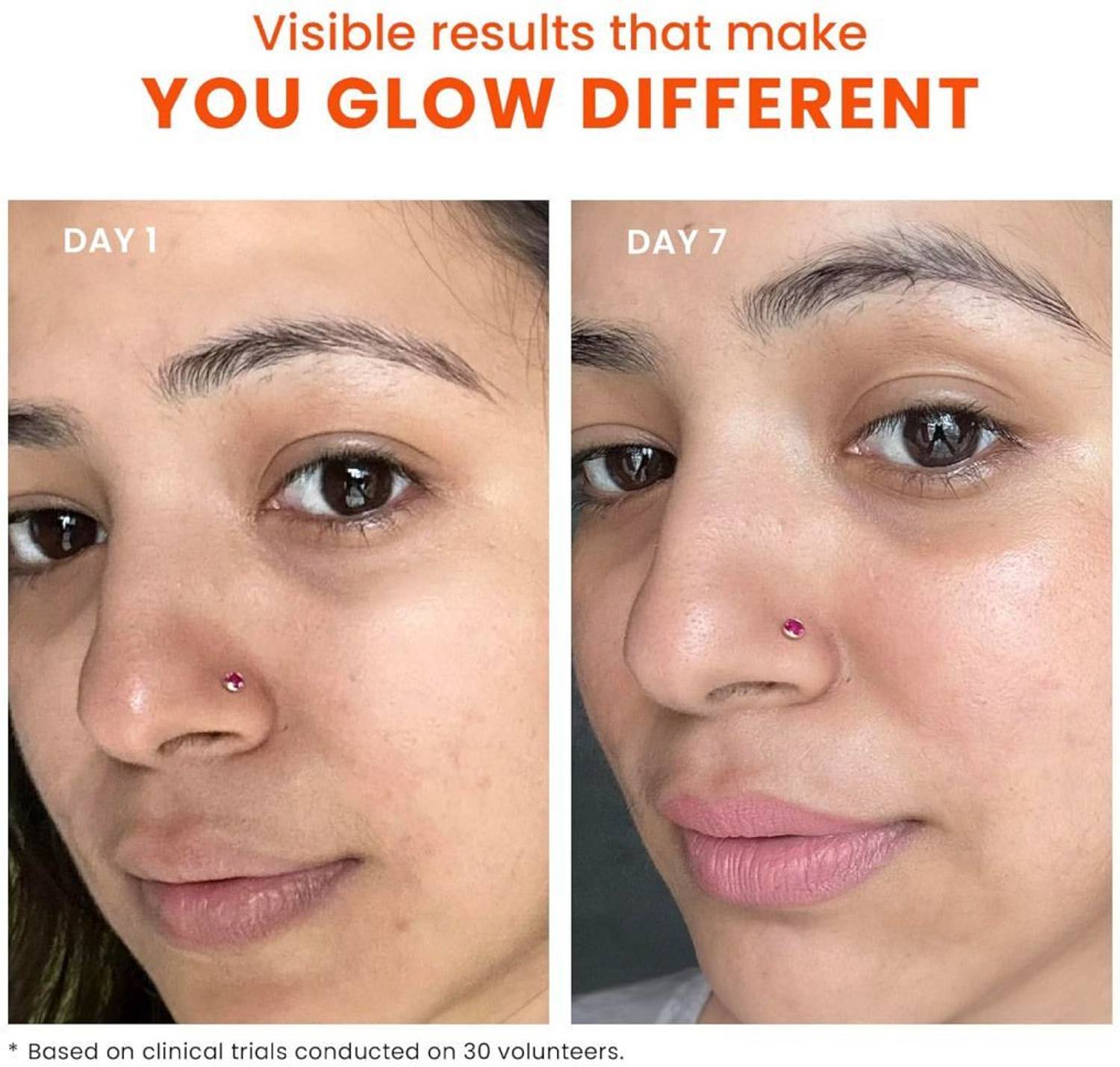 Foxtale Sunscreen SPF 70 PA++++ Dewy with Niacinamide 50ml - Image 5