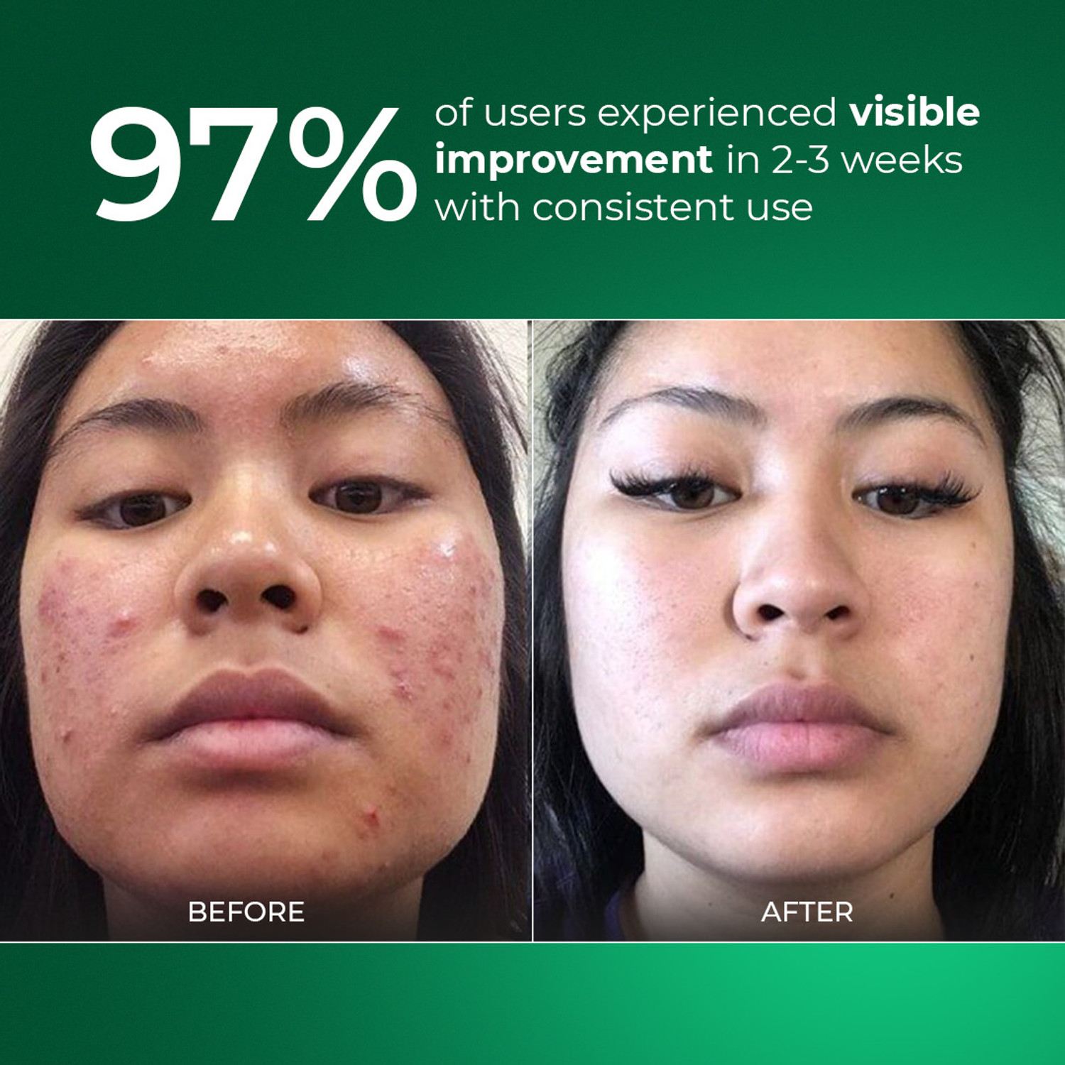 Image of Aqueria Sunscreen - SPF 50 PA++++ Oil Control Brightening French Multi-Active SPF | 2% Niacinamide, Salicylic Acid